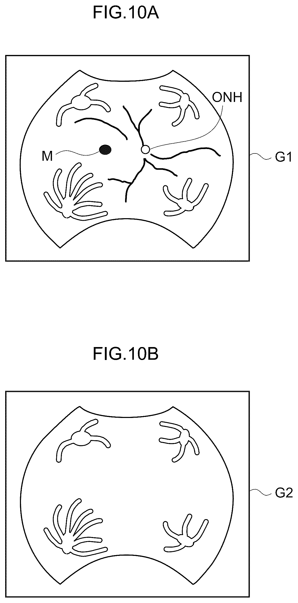 Patent US12361590 Figure 10 – Image processing method, image processing device, and program