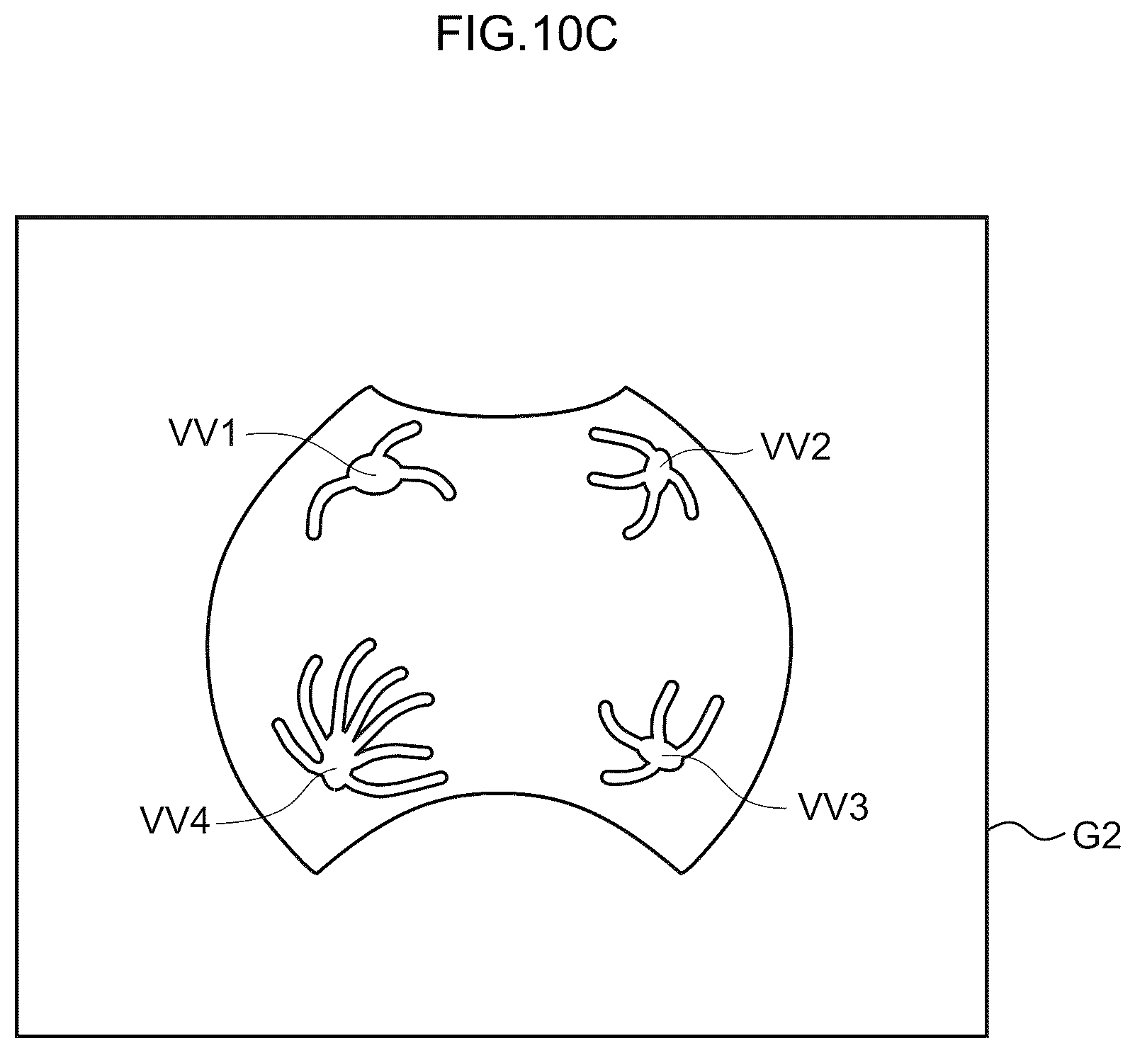 Patent US12361590 Figure 11 – Image processing method, image processing device, and program