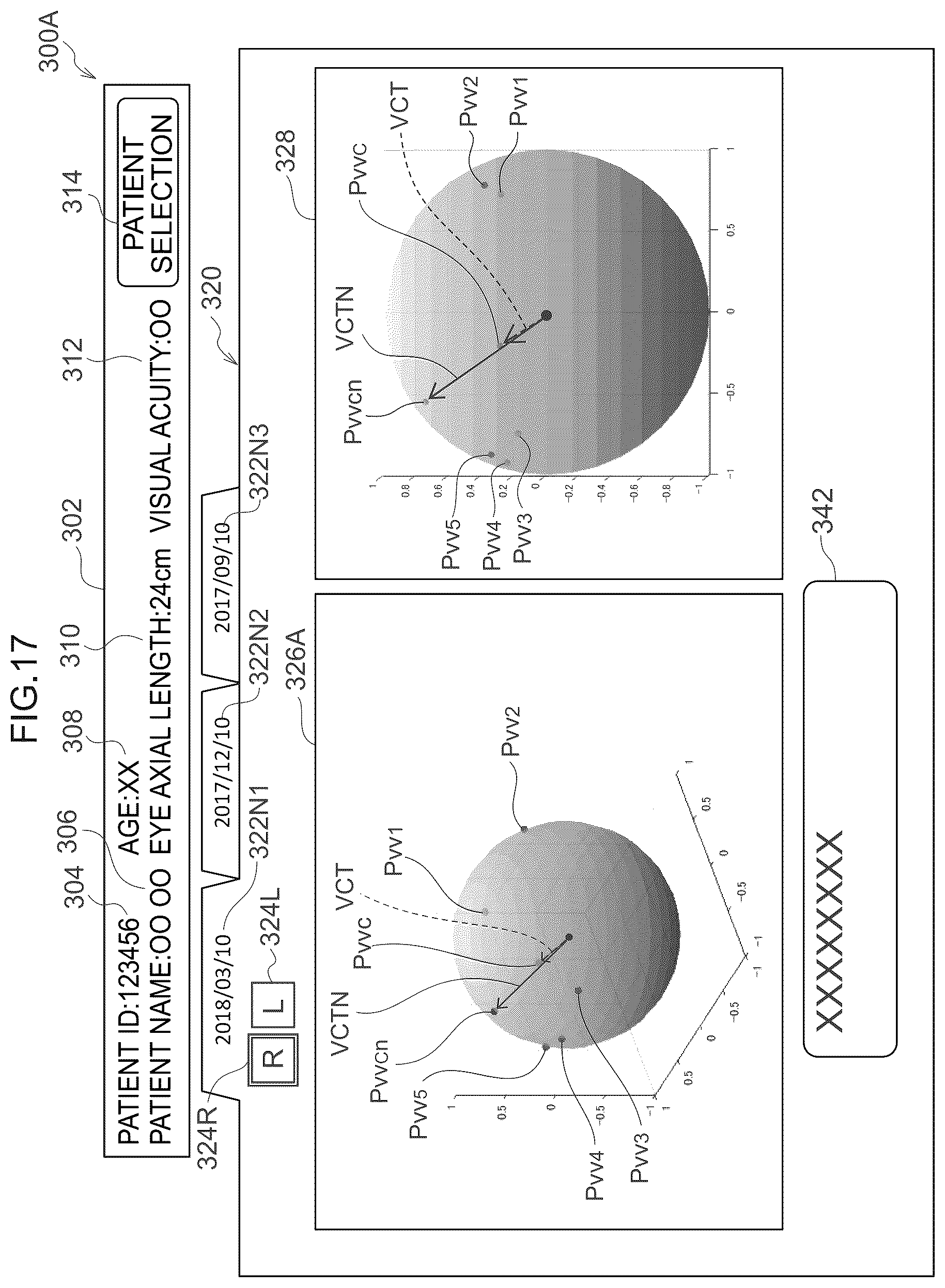 Patent US12361590 Figure 18 – Image processing method, image processing device, and program