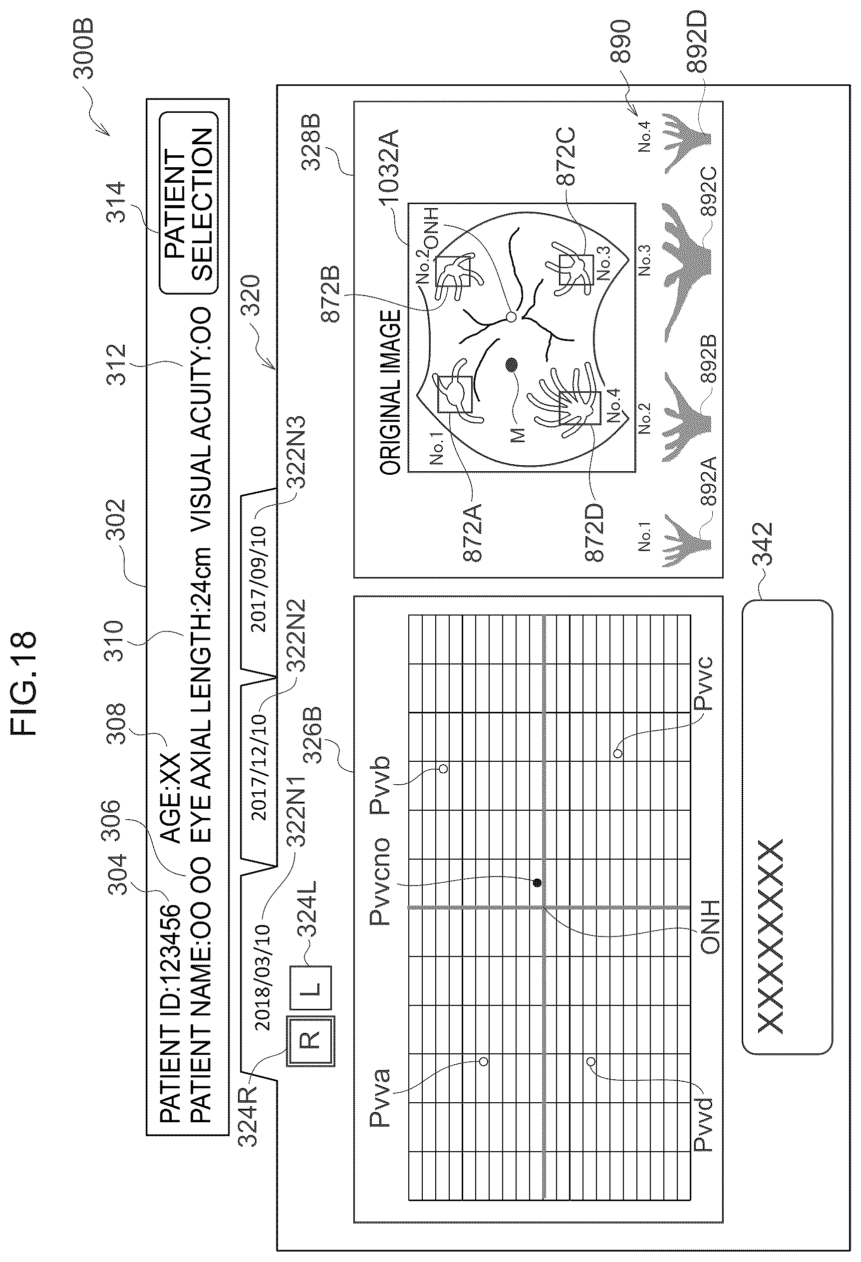 Patent US12361590 Figure 19 – Image processing method, image processing device, and program