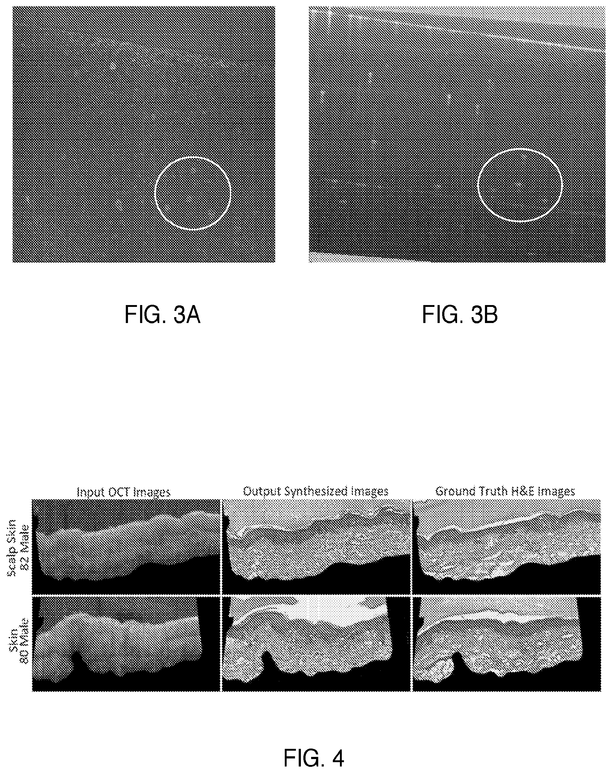 Patent US12361656 Figure 4 – High resolution alignment of 3D imaging with 2D imaging