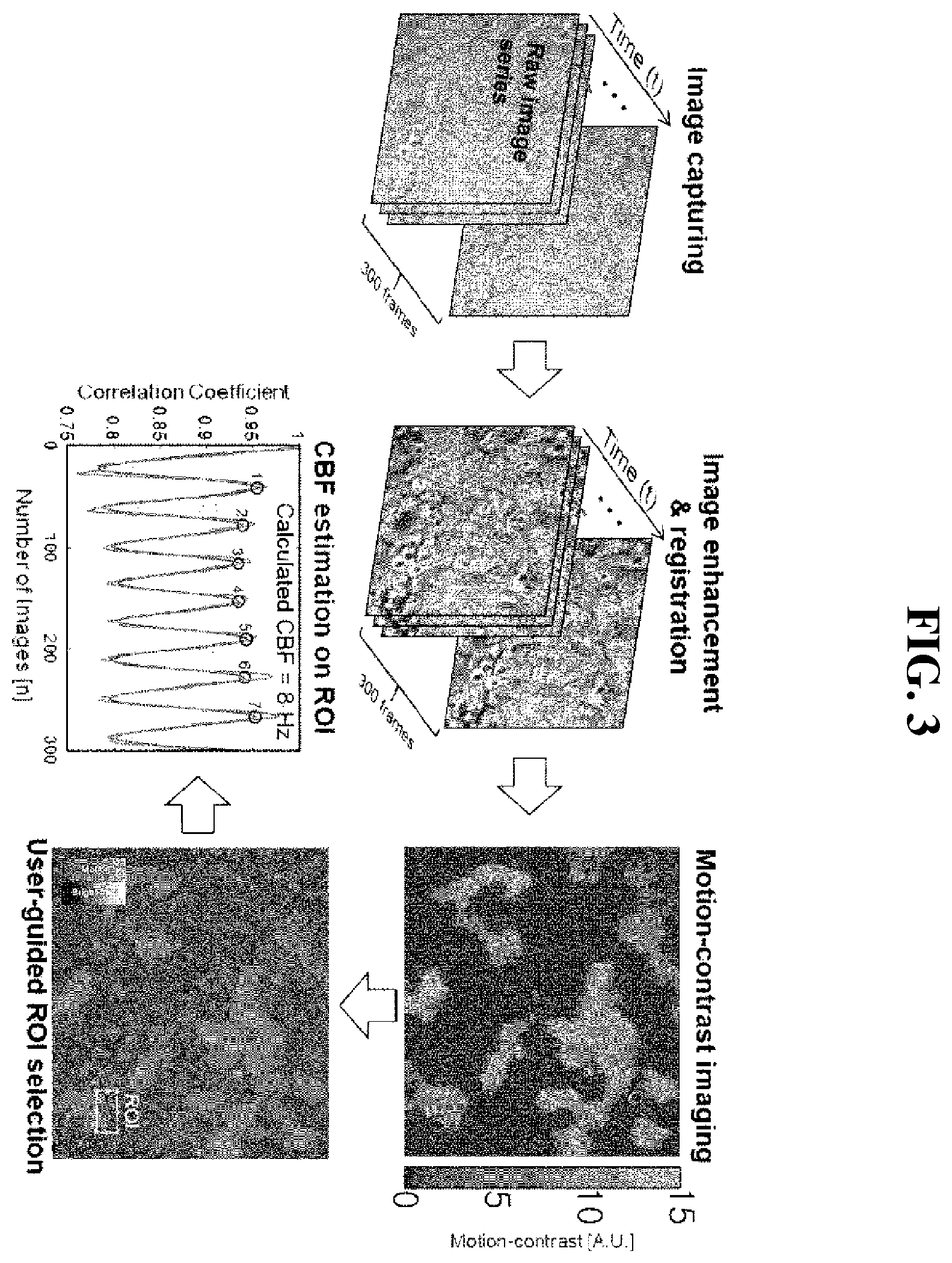 Patent US12361668 Figure 3 – Method and apparatus for measuring motility of ciliated cells in respiratory tract