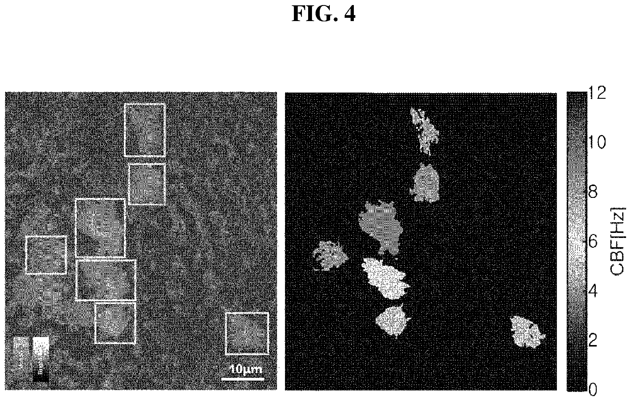 Patent US12361668 Figure 4 – Method and apparatus for measuring motility of ciliated cells in respiratory tract