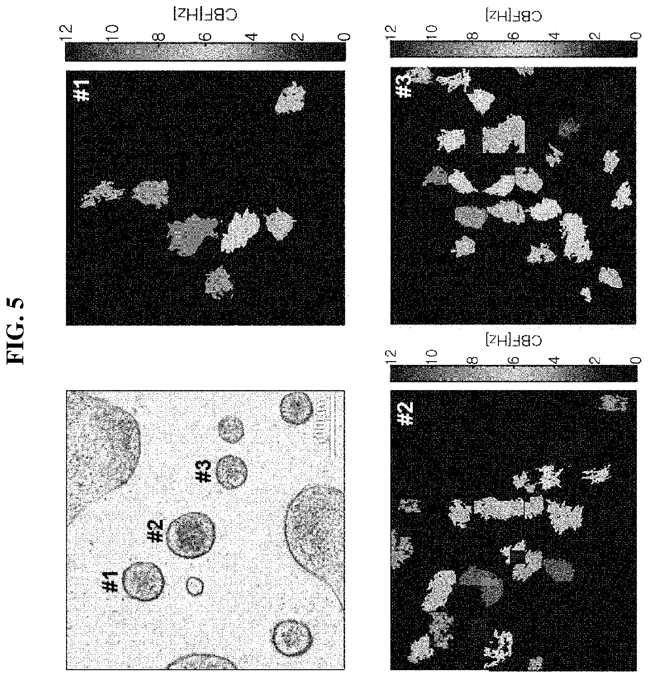 Patent US12361668 Figure 5 – Method and apparatus for measuring motility of ciliated cells in respiratory tract