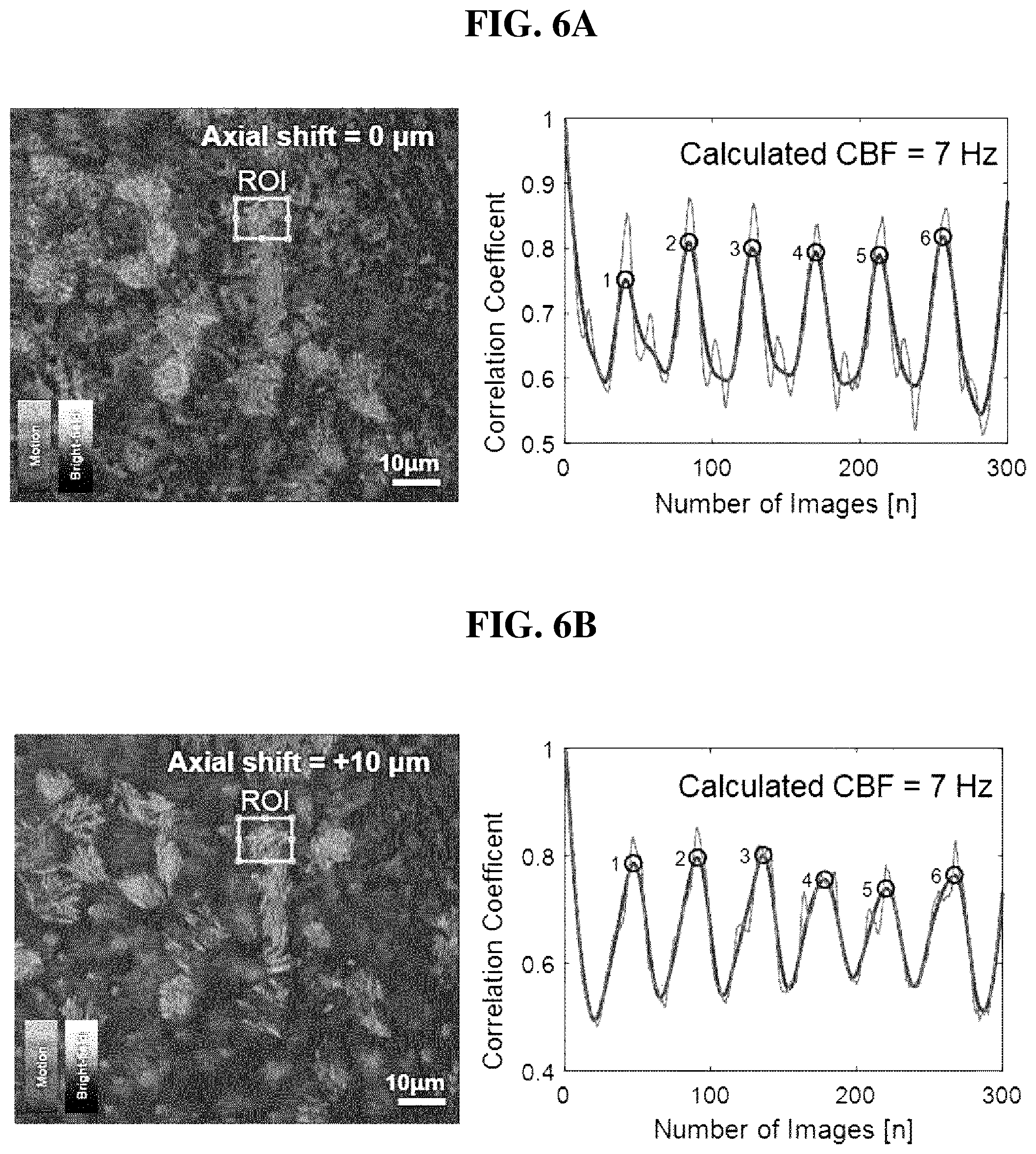 Patent US12361668 Figure 6 – Method and apparatus for measuring motility of ciliated cells in respiratory tract
