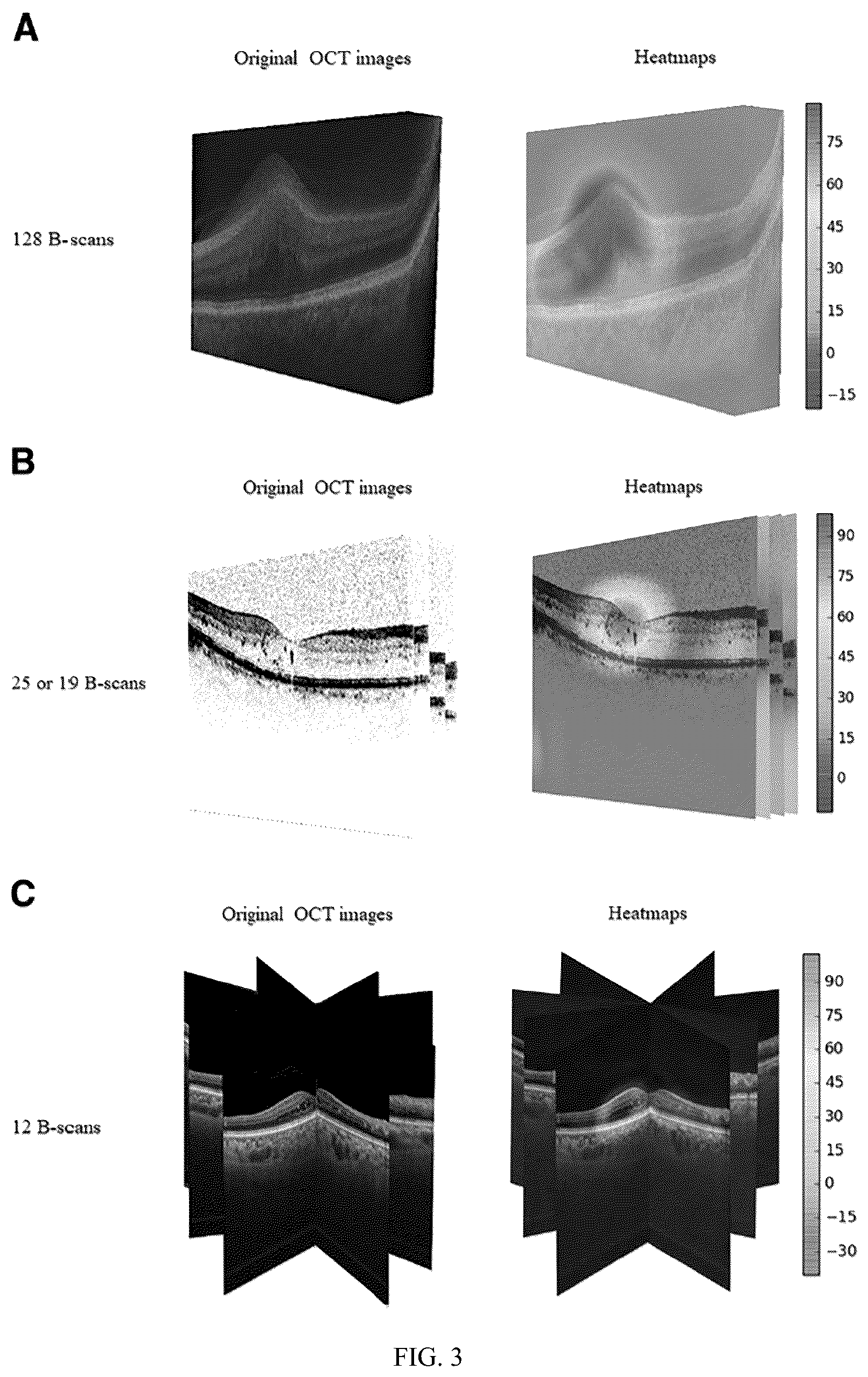 Patent US12361697 Figure 5 – Multi-task deep-learning method and system to classify diabetic macular edema for different optical coherence tomography devices