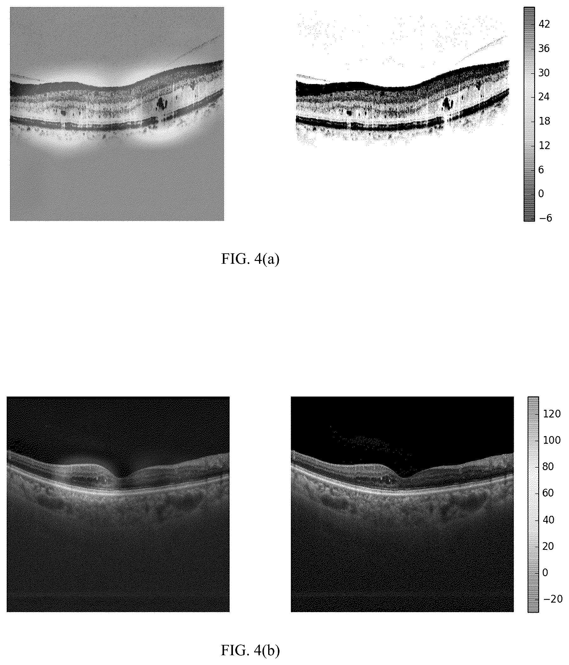Patent US12361697 Figure 6 – Multi-task deep-learning method and system to classify diabetic macular edema for different optical coherence tomography devices
