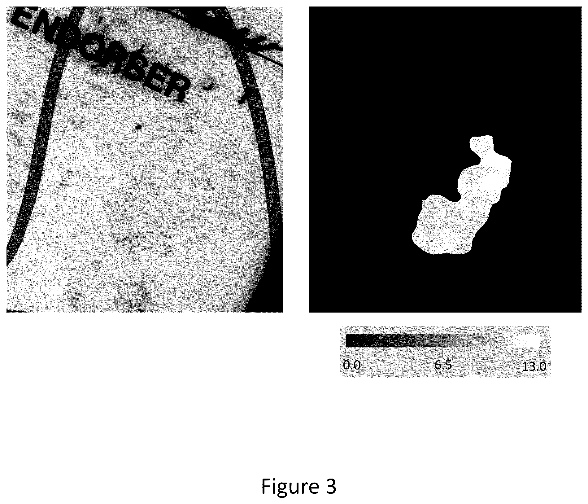 Patent US12361748 Figure 2 – Method for estimating an inter-ridge distance relating to a fingerprint