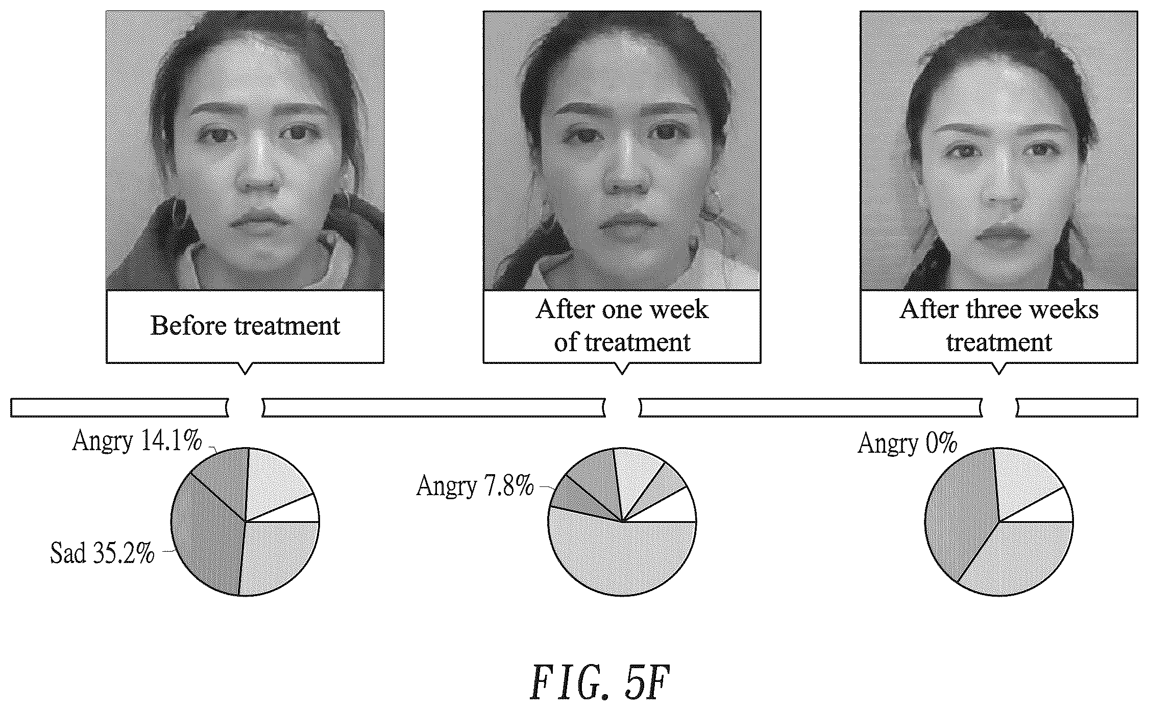 Patent US12361756 Figure 11 – Artificial intelligence-assisted evaluation method for aesthetic medicine and evaluation system using same