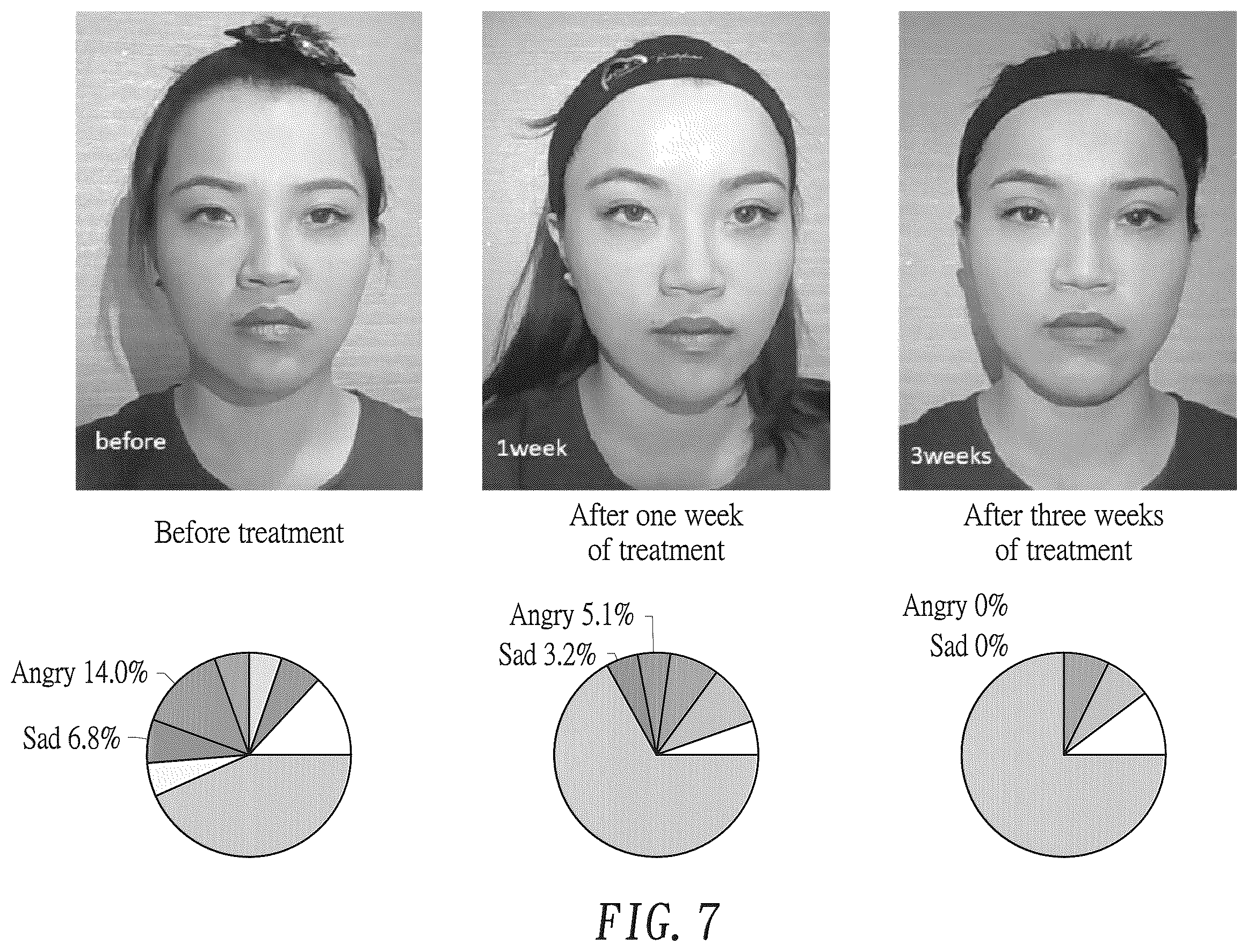 Patent US12361756 Figure 13 – Artificial intelligence-assisted evaluation method for aesthetic medicine and evaluation system using same
