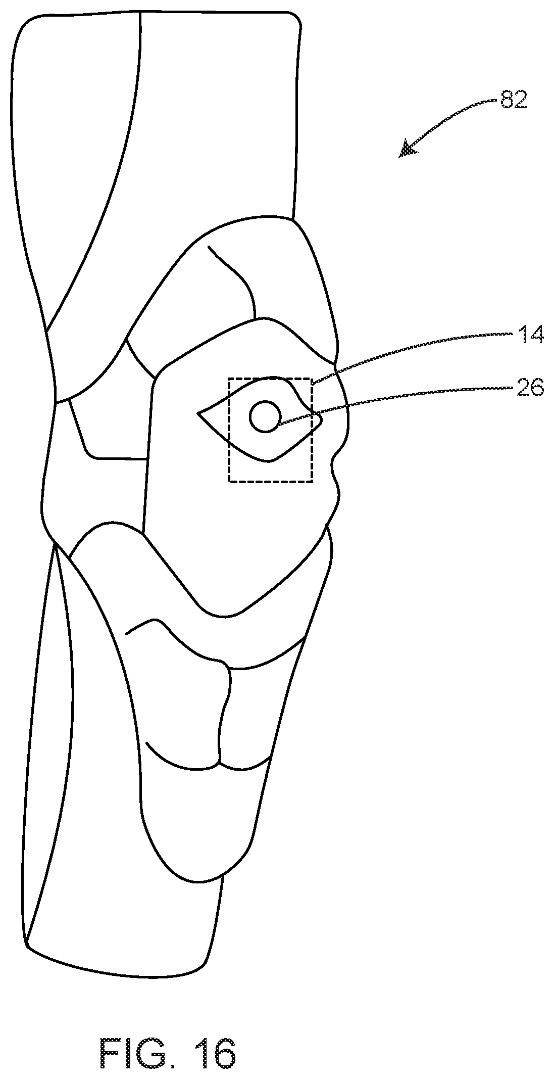Patent US12361811 Figure 15 – System for monitoring vehicle riders