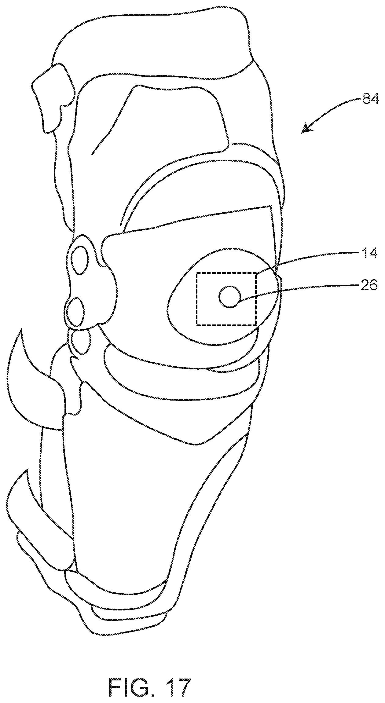 Patent US12361811 Figure 16 – System for monitoring vehicle riders