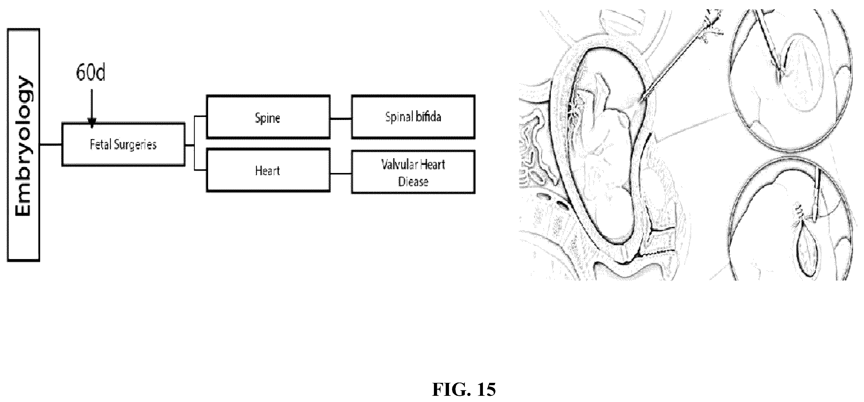 Patent US12361839 Figure 15 – System and method for simulation and understanding embryology
