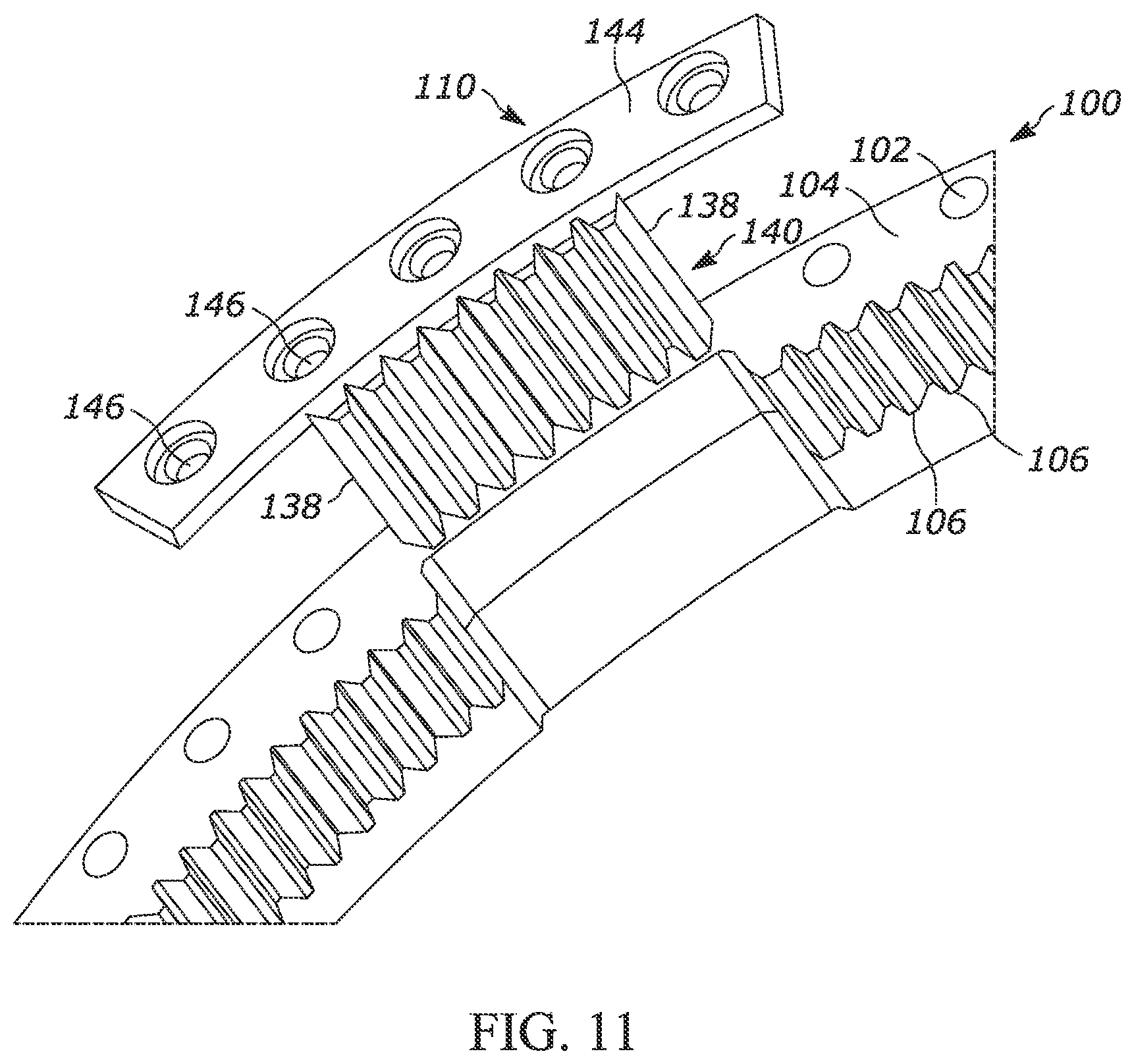 Patent US12365057 Figure 9 – Method for replacing at least one tooth of a gear