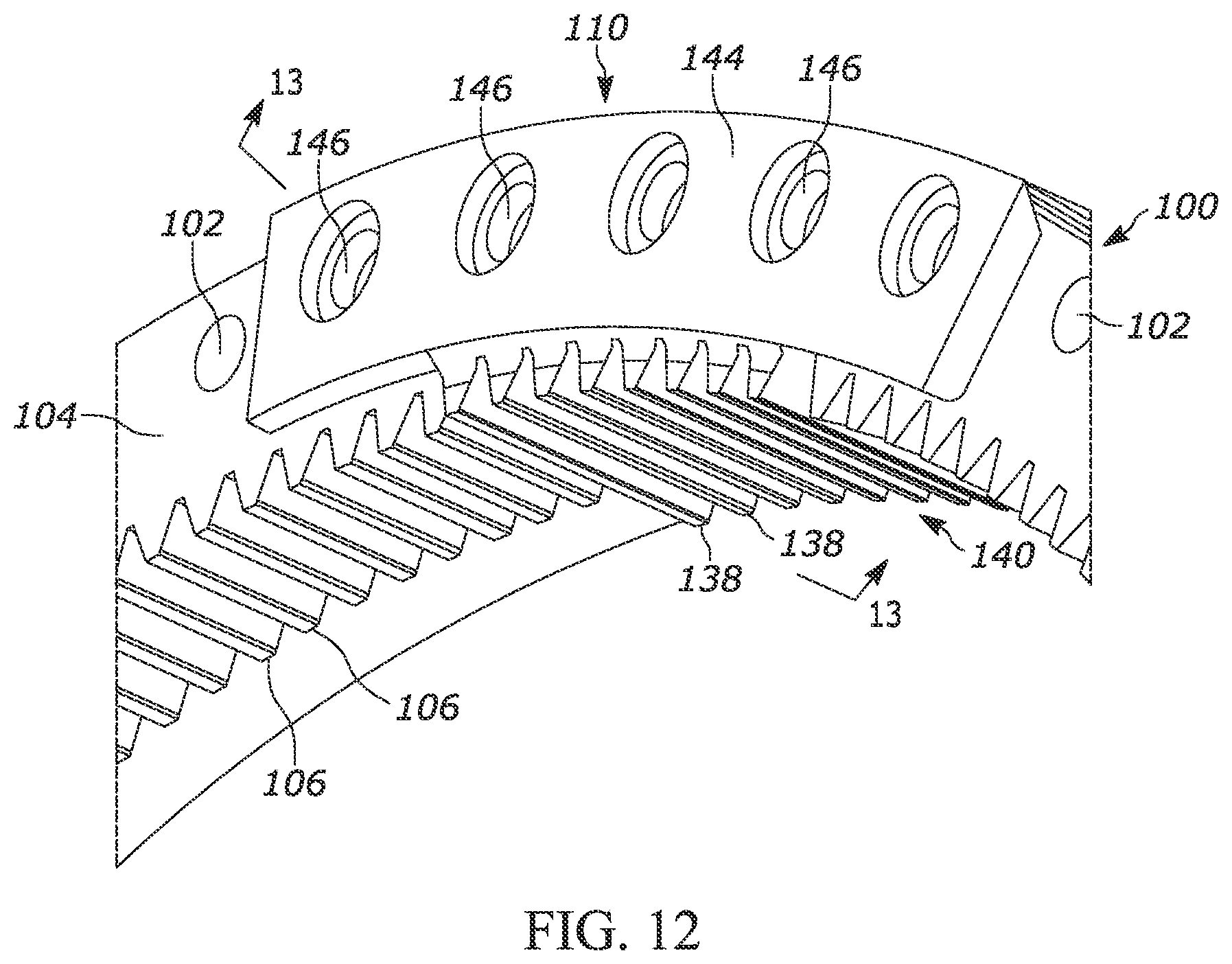 Patent US12365057 Figure 10 – Method for replacing at least one tooth of a gear