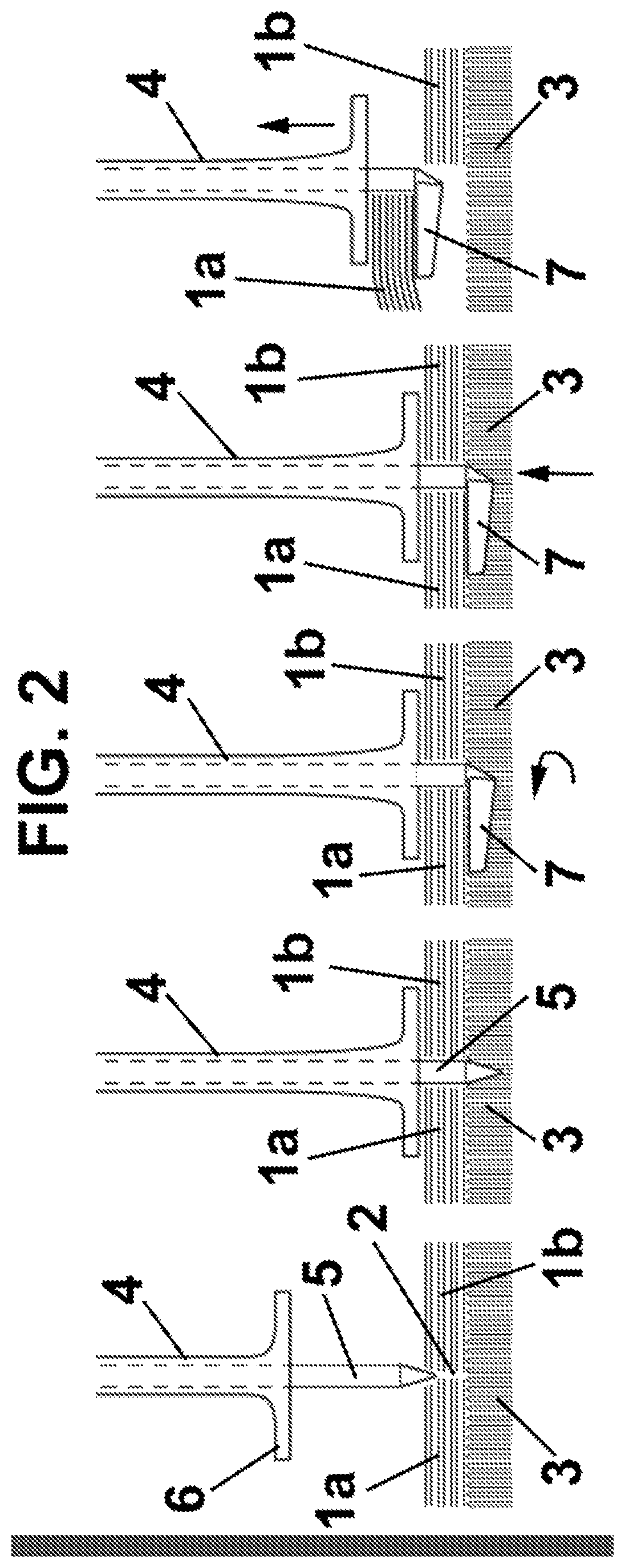Patent US12365099 Figure 2 – Device and method for handling elements