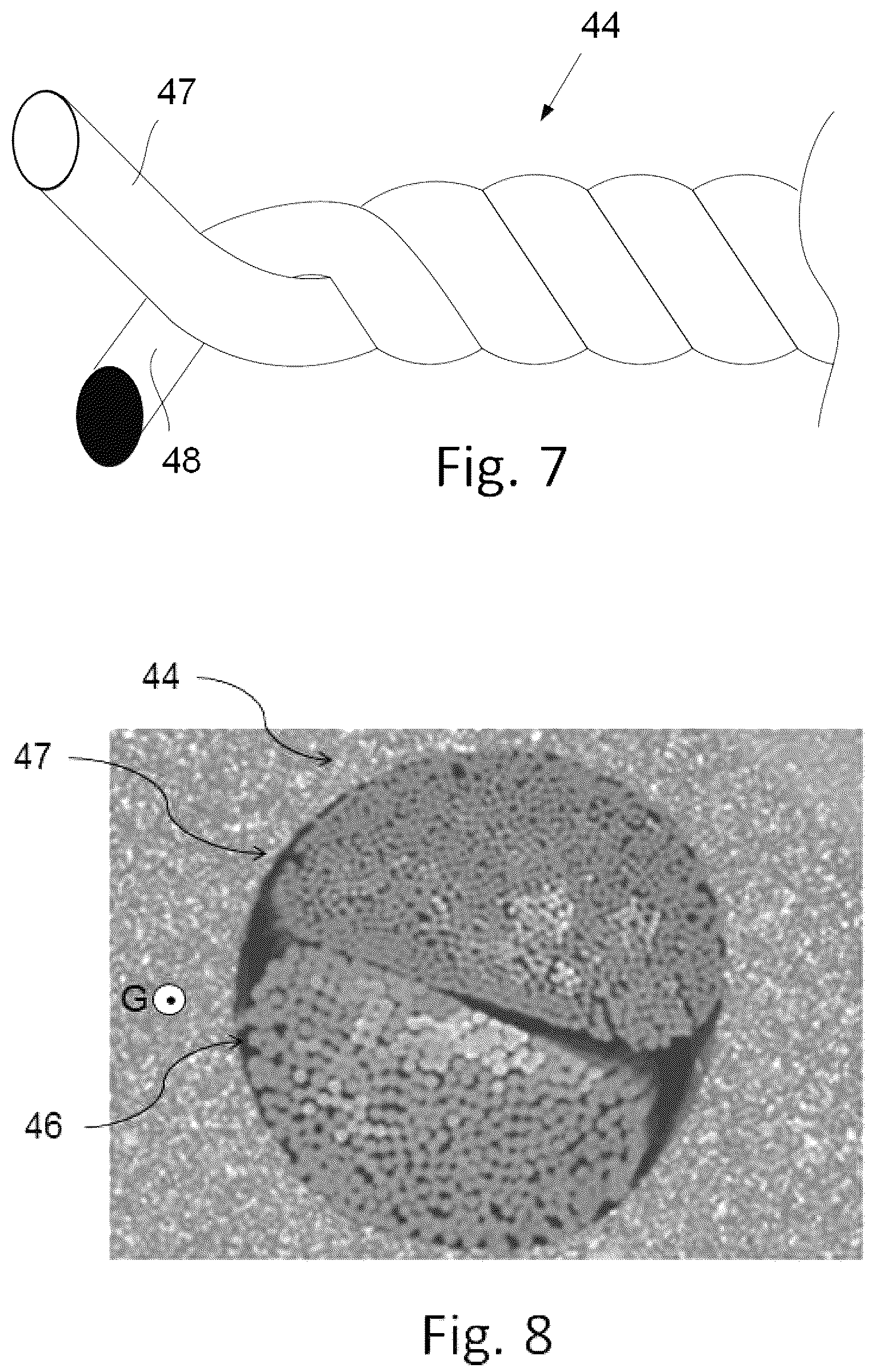 Patent US12365203 Figure 6 – Tire comprising a single carcass ply with reduced deformation depth in the sidewall after running in