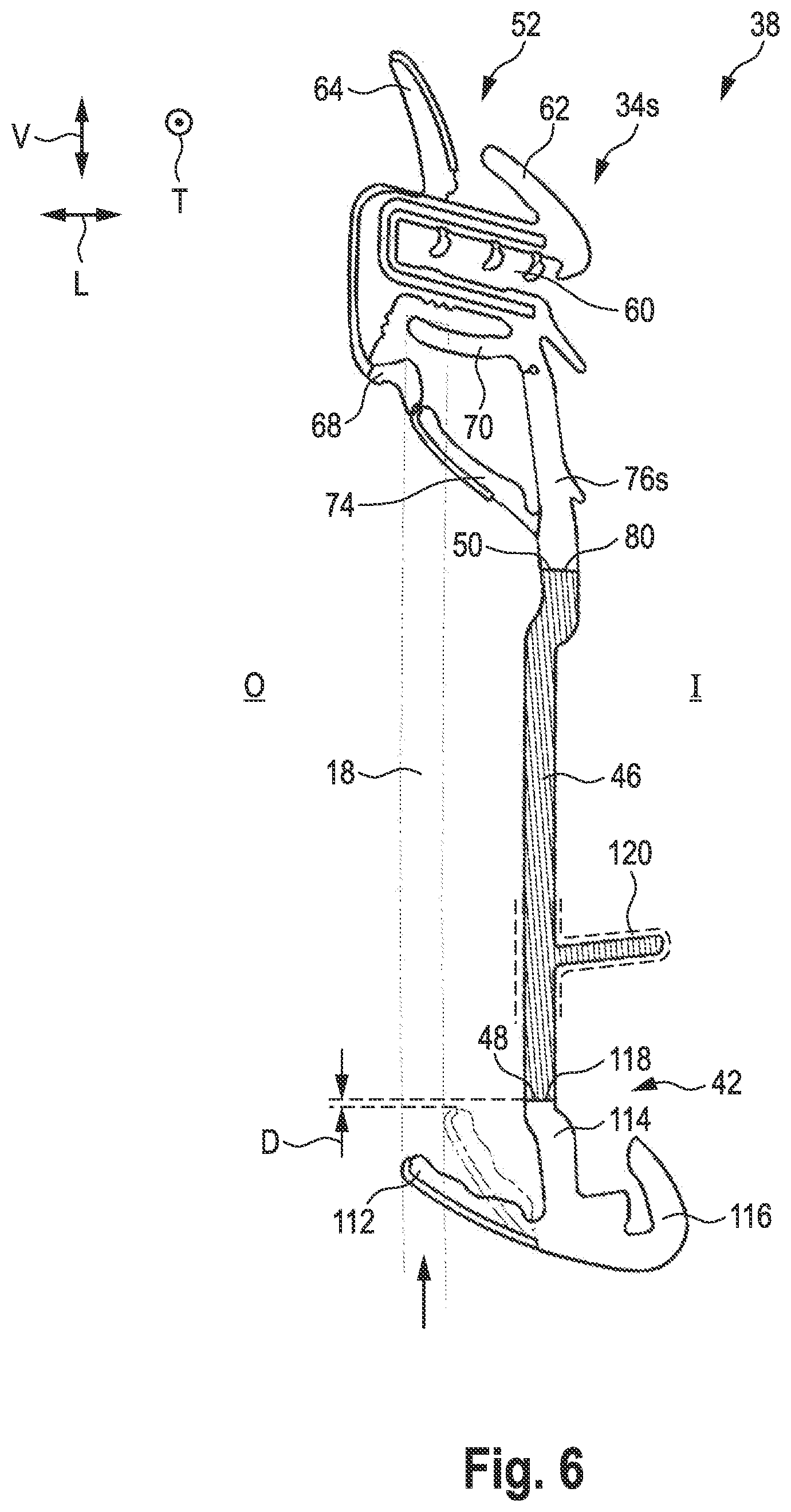 Patent US12365224 Figure 4 – Sealing arrangement and method for producing same