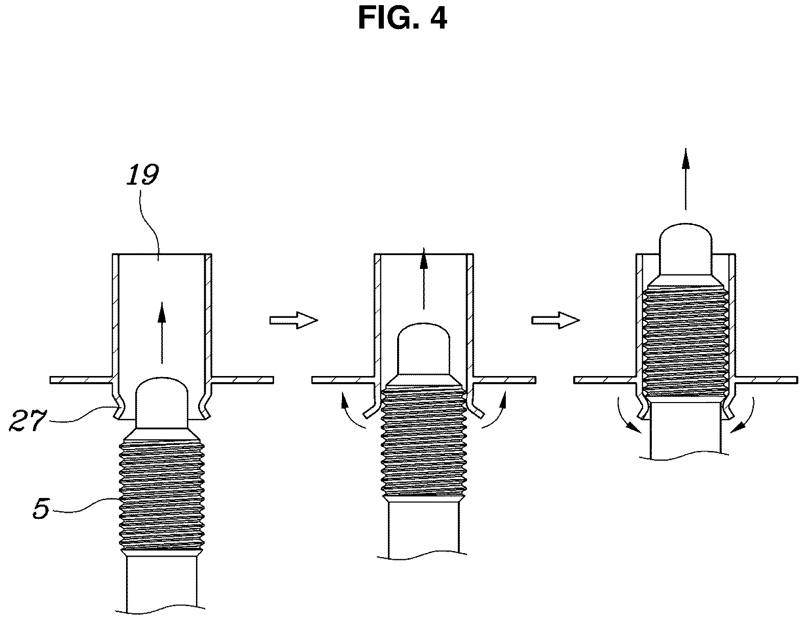 Patent US12365229 Figure 4 – Vehicle battery assembly mounting structure
