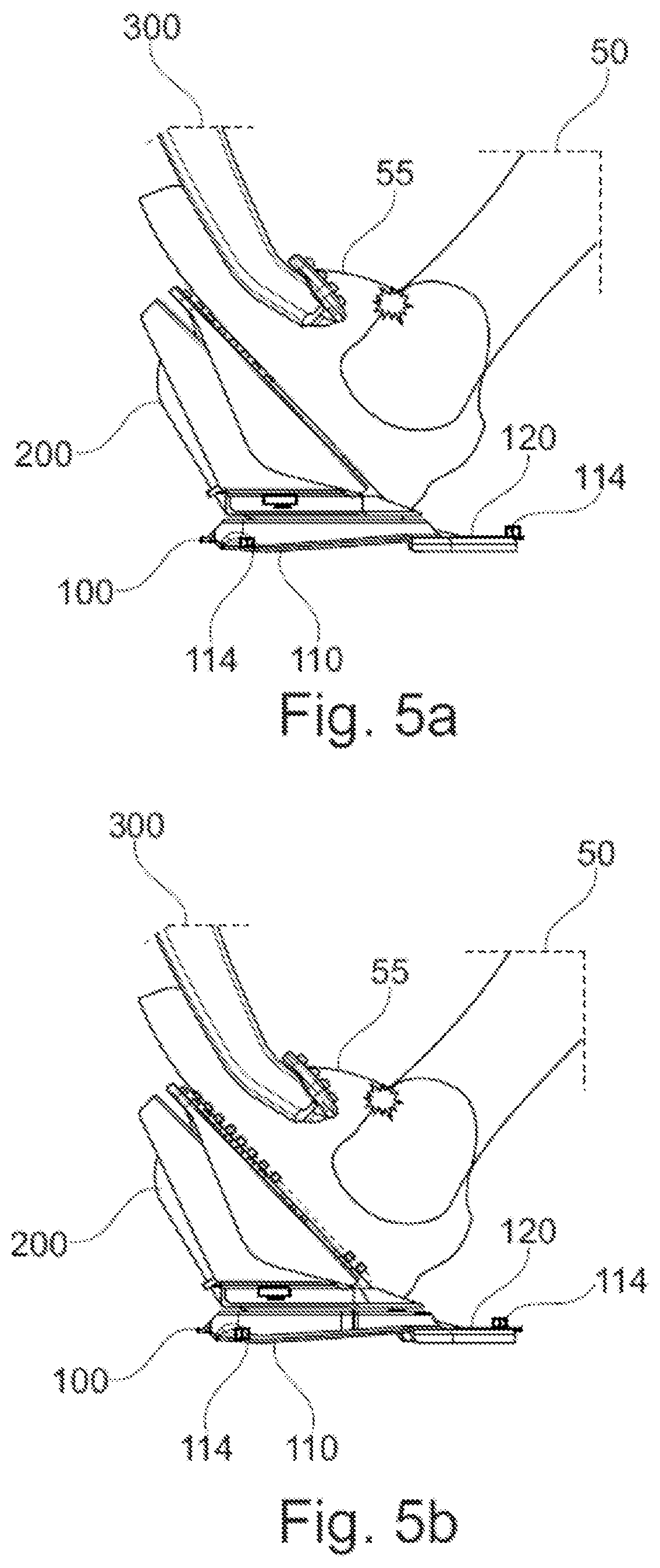 Patent US12365242 Figure 4 – Accelerator pedal assembly for a vehicle