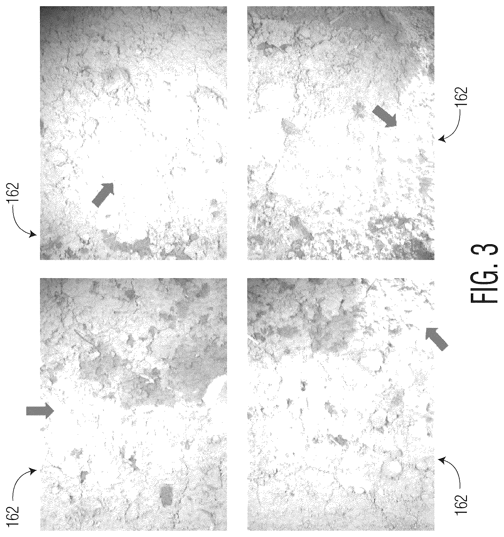 Patent US12365284 Figure 4 – High intensity illumination systems and methods of use thereof