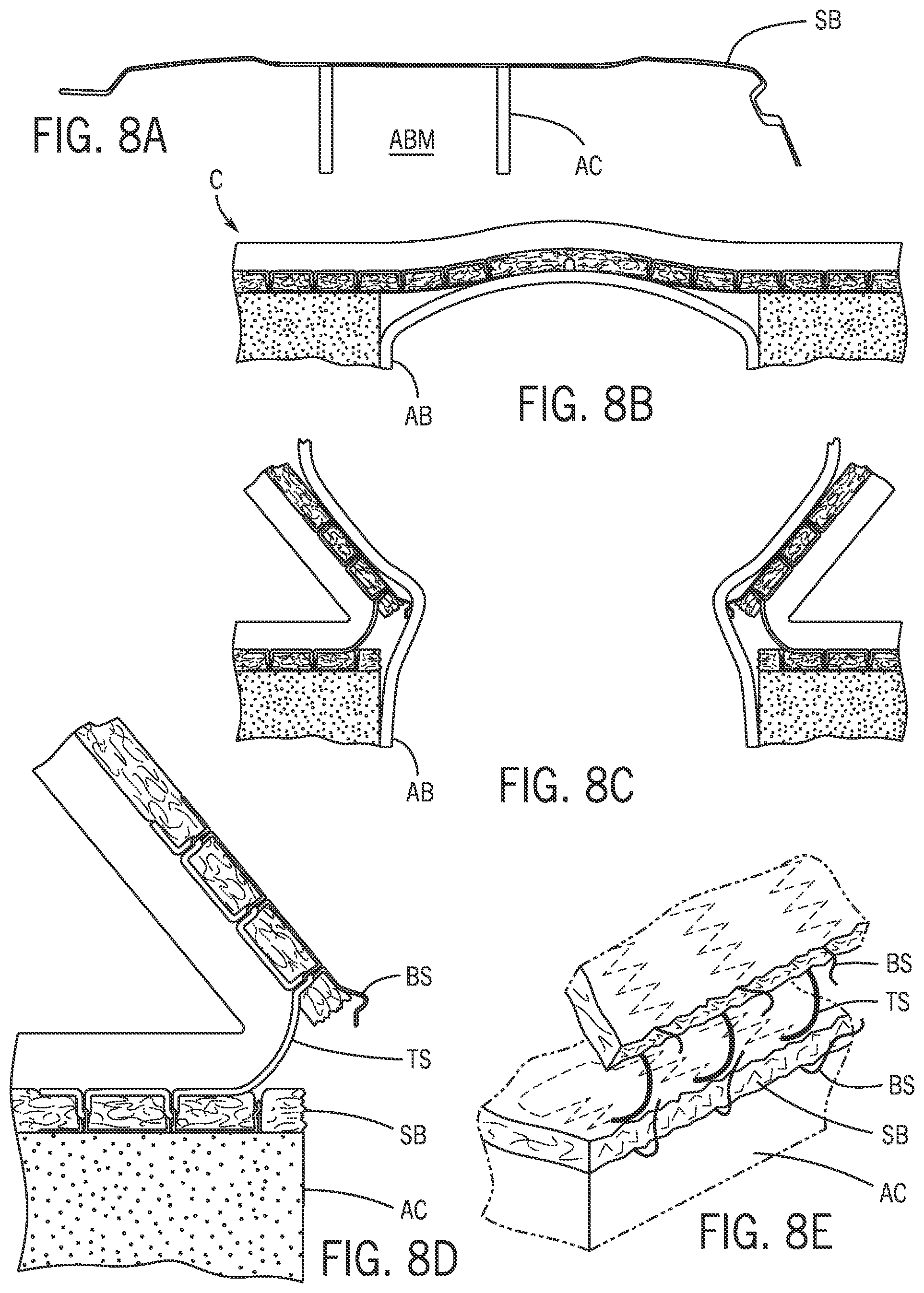 Patent US12365301 Figure 8 – Vehicle trim component