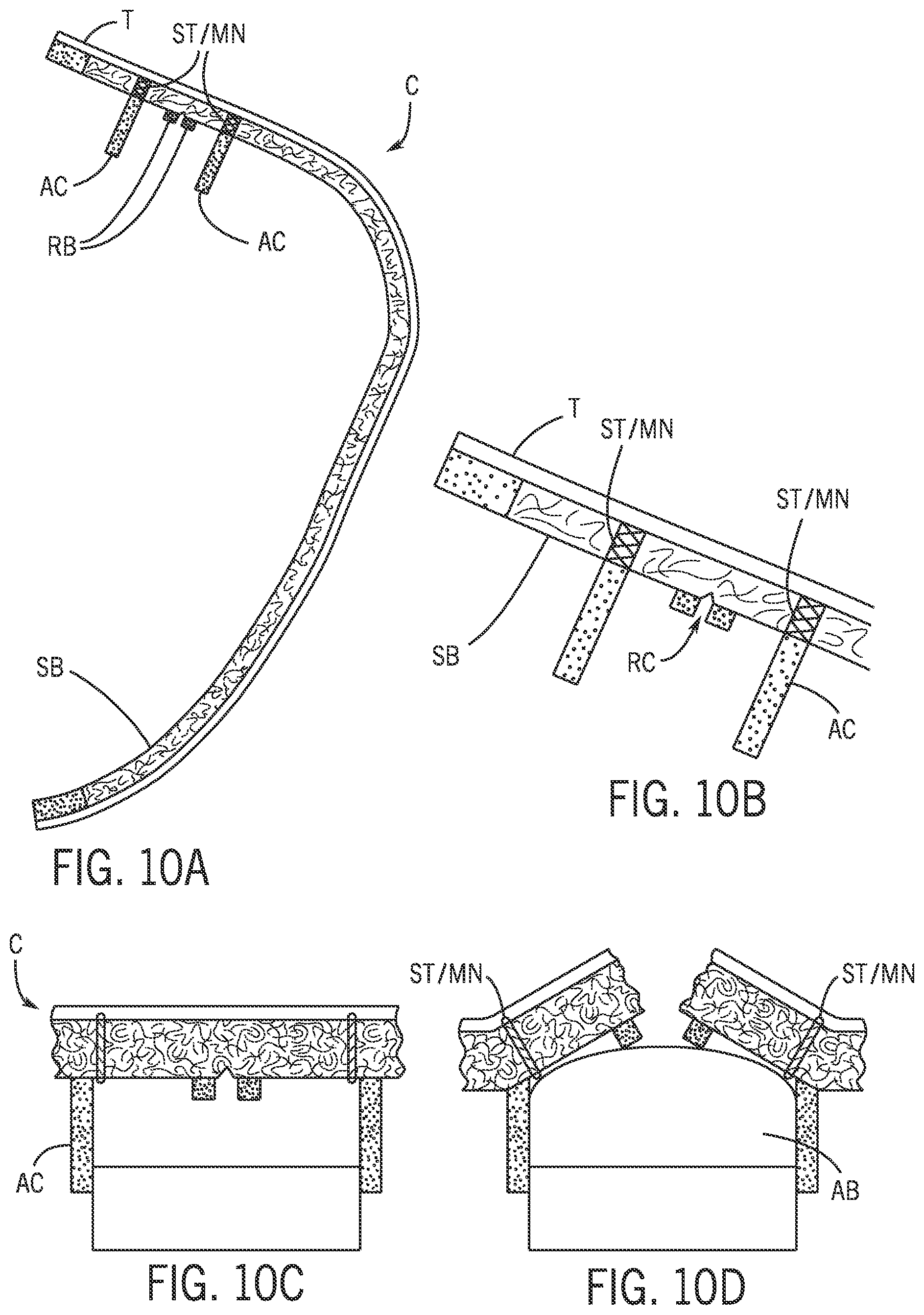 Patent US12365301 Figure 10 – Vehicle trim component