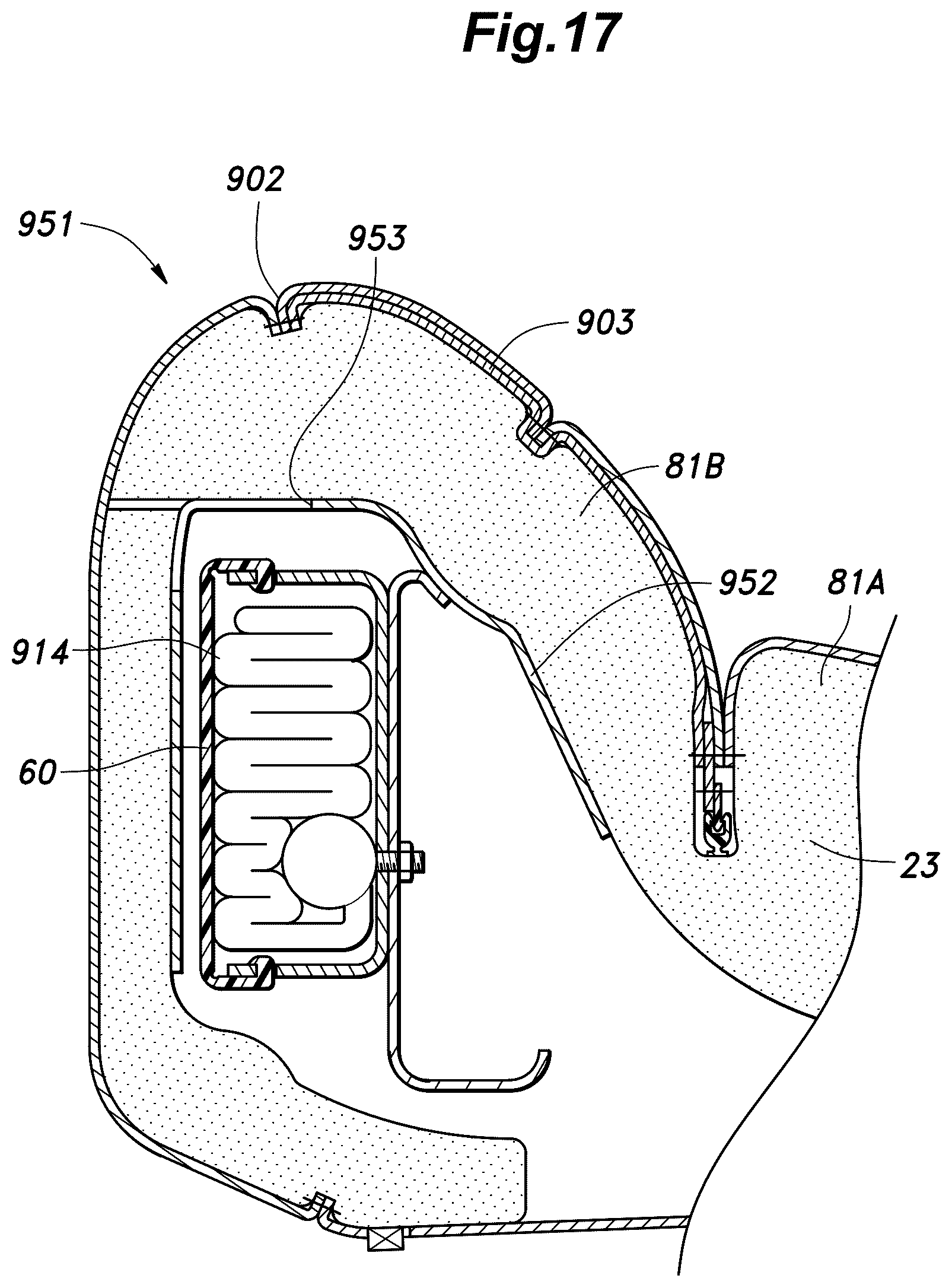 Patent US12365302 Figure 17 – Vehicle seat and method for manufacturing the same