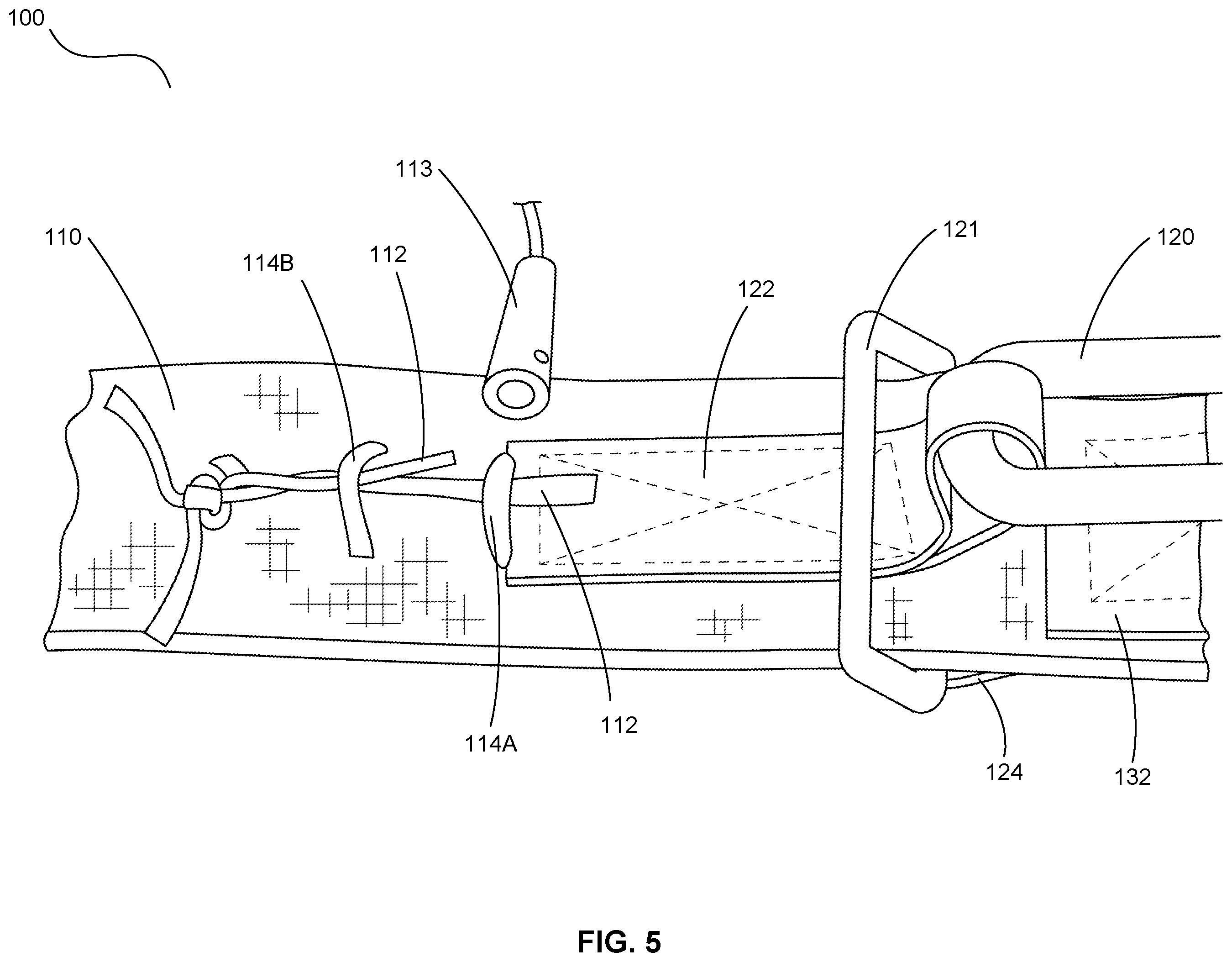 Patent US12365467 Figure 6 – Ring release systems and methods utilizing a removable pin