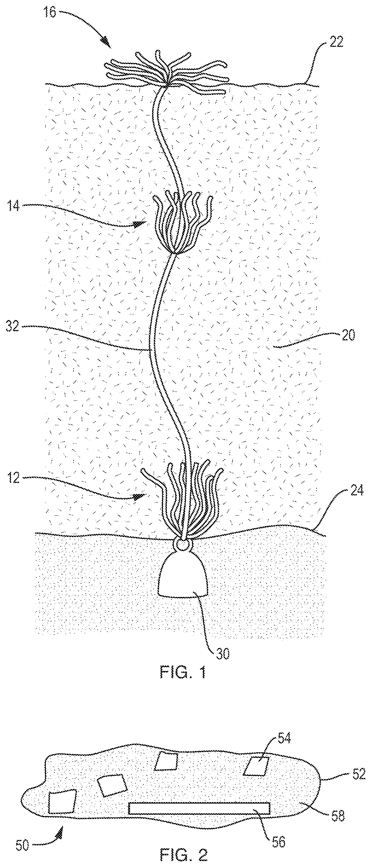Patent US12365602 Figure 1 – Removal and detection of algae, their toxins, and excess nutrients, other contaminants, and toxic substances