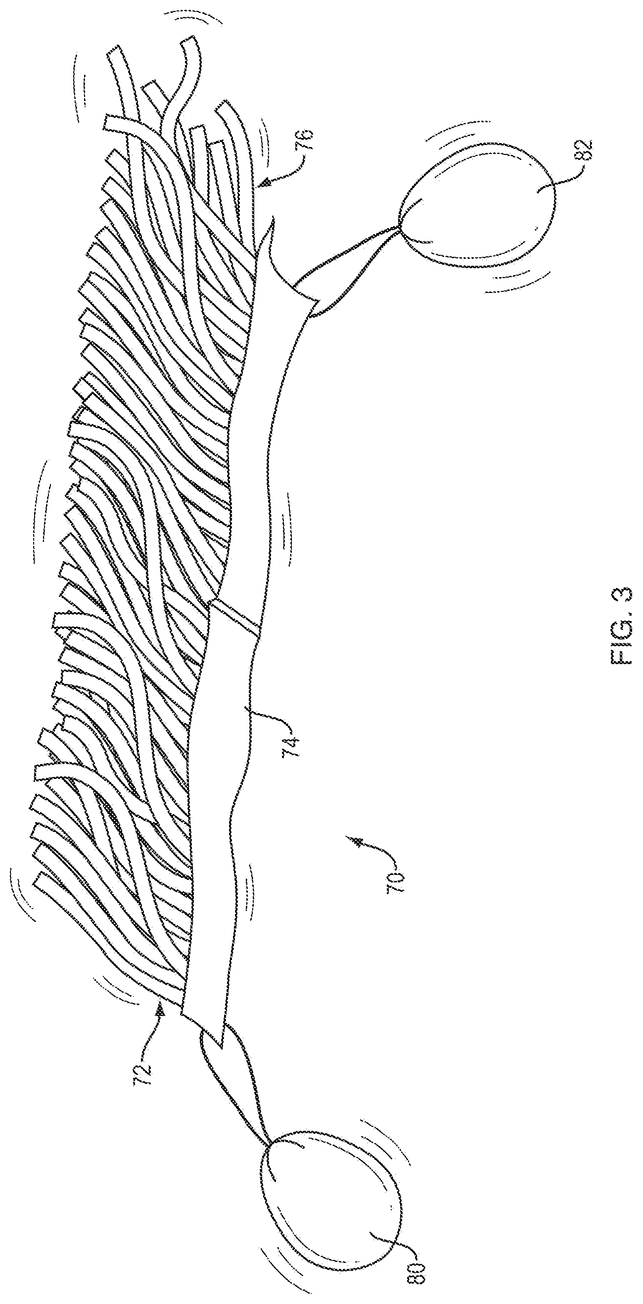 Patent US12365602 Figure 2 – Removal and detection of algae, their toxins, and excess nutrients, other contaminants, and toxic substances
