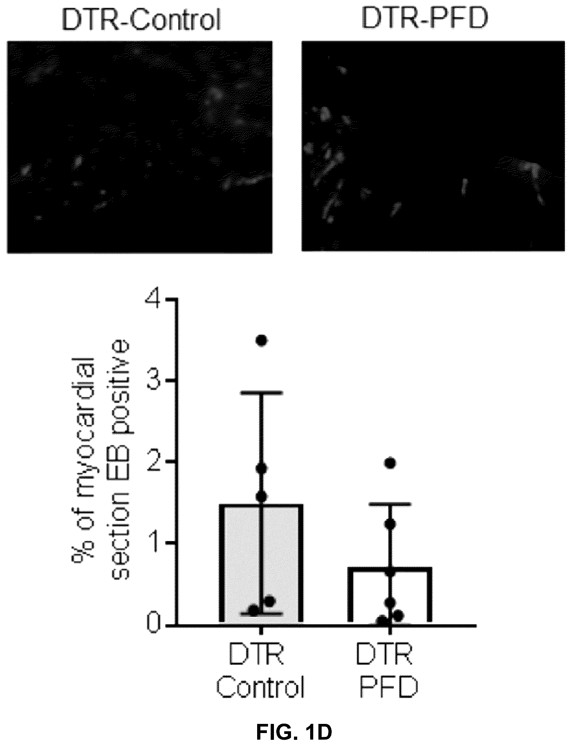 Patent US12365651 Figure 4 – Use of pirfenidone and derivatives for modulation of B lymphocyte activity and organ protection from acute tissue damage