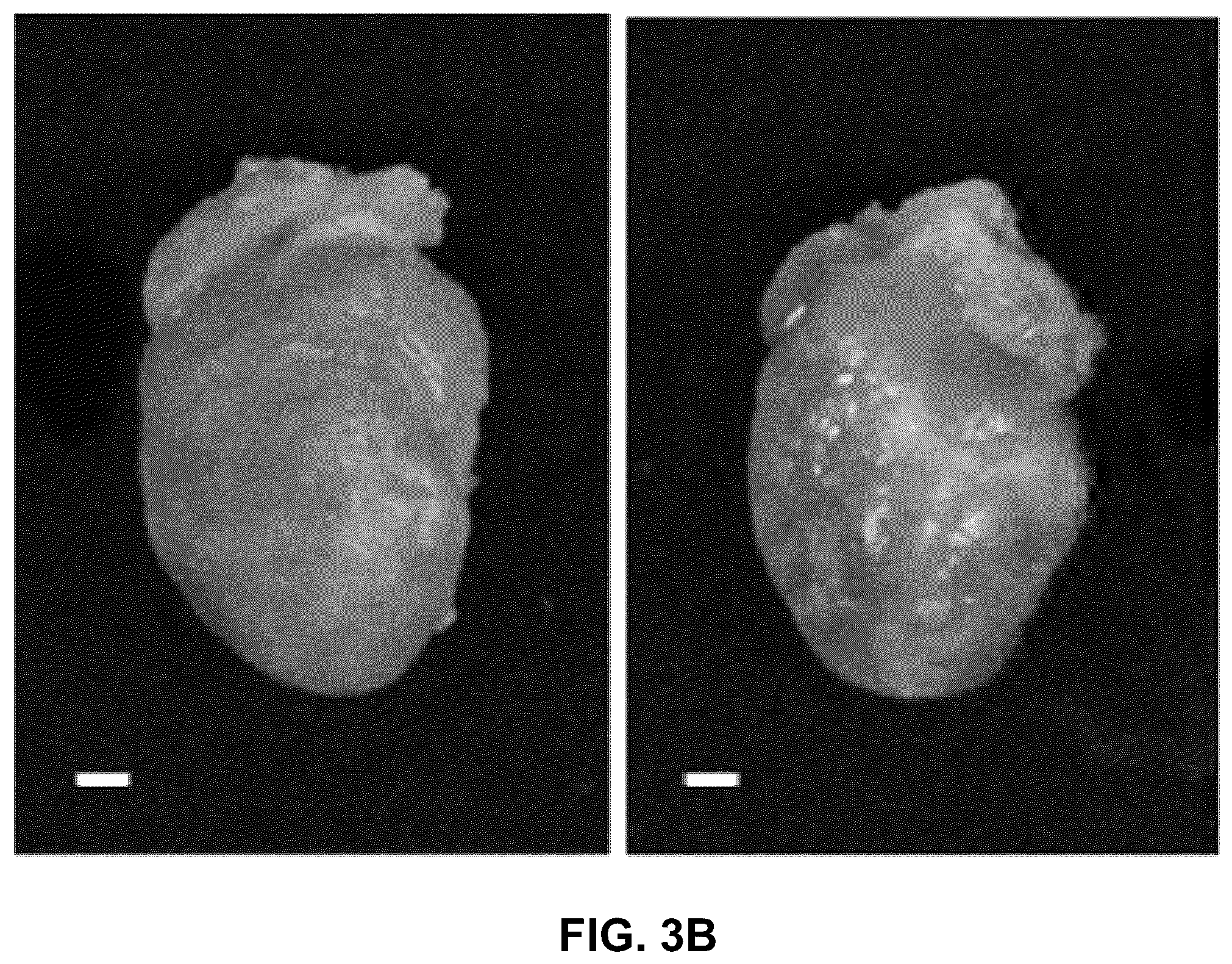 Patent US12365651 Figure 10 – Use of pirfenidone and derivatives for modulation of B lymphocyte activity and organ protection from acute tissue damage