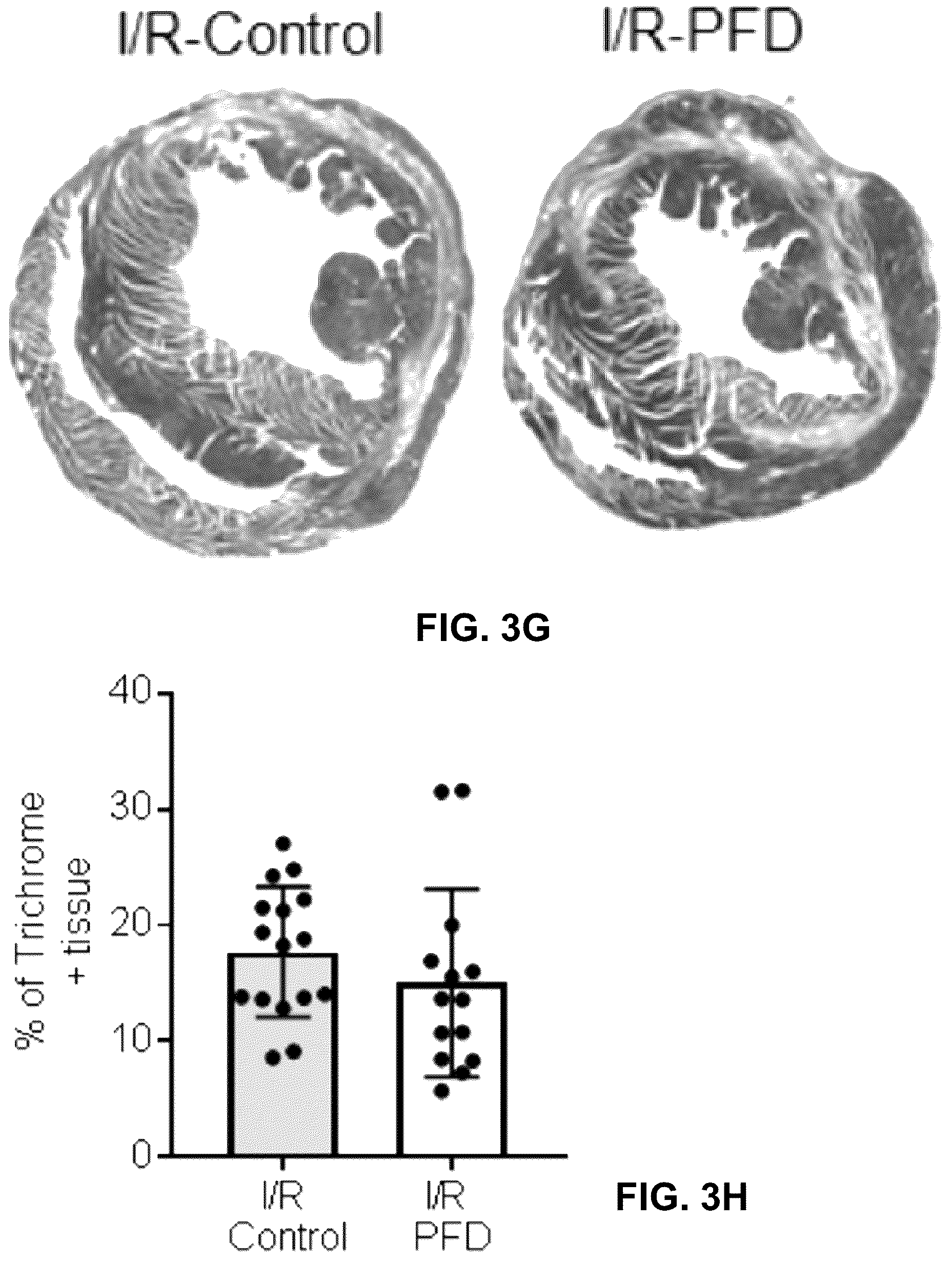 Patent US12365651 Figure 13 – Use of pirfenidone and derivatives for modulation of B lymphocyte activity and organ protection from acute tissue damage