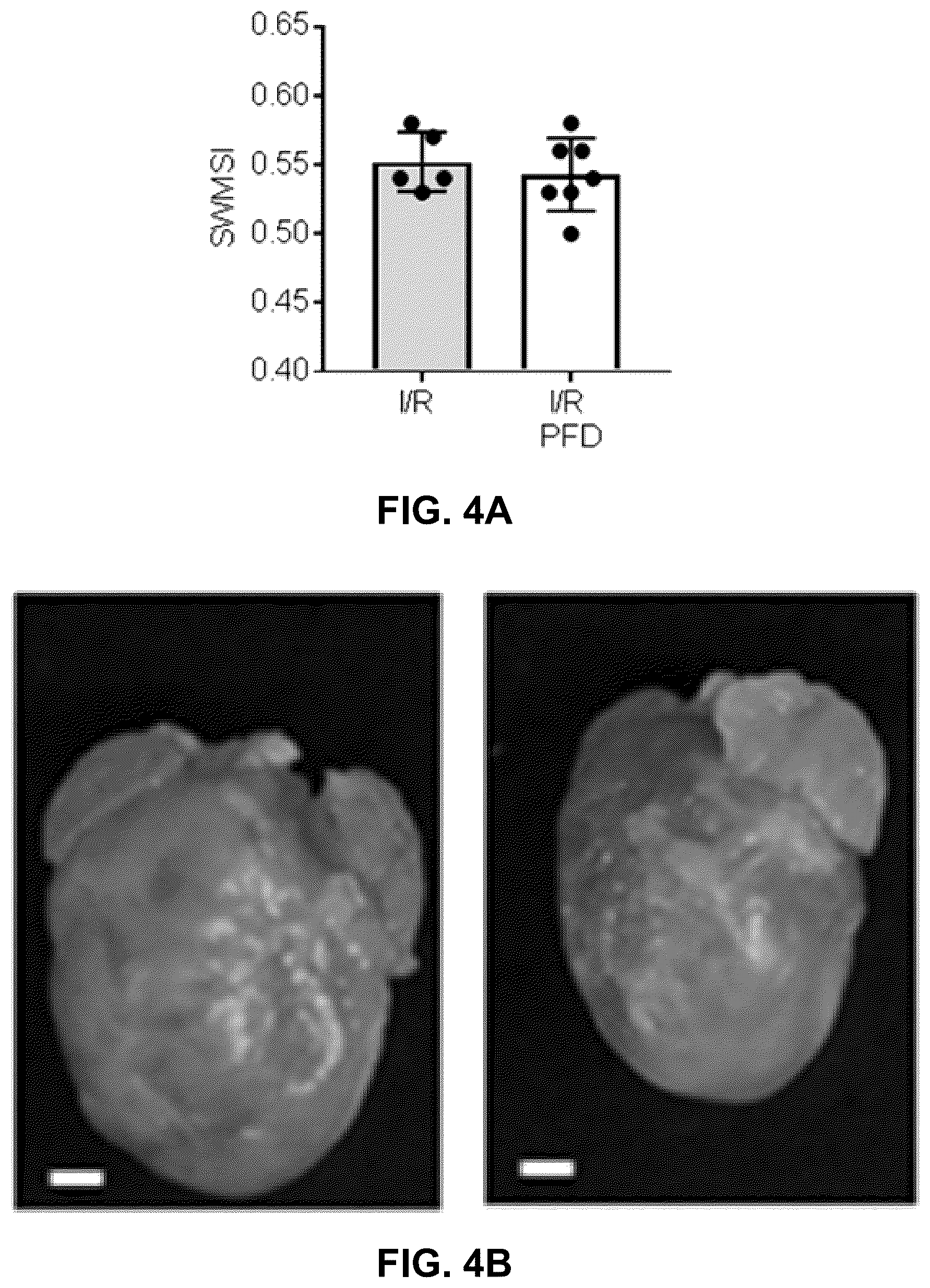 Patent US12365651 Figure 14 – Use of pirfenidone and derivatives for modulation of B lymphocyte activity and organ protection from acute tissue damage