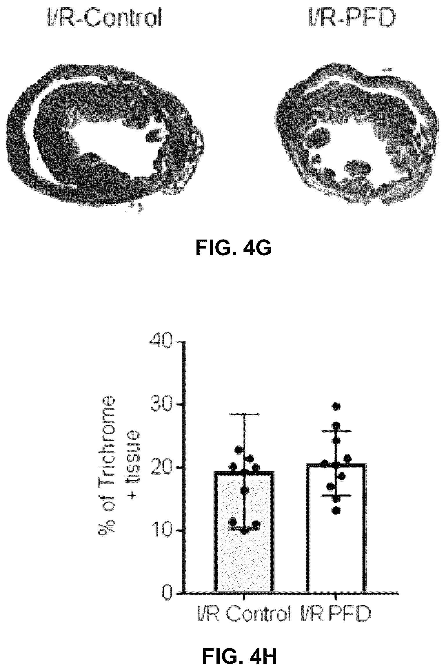 Patent US12365651 Figure 17 – Use of pirfenidone and derivatives for modulation of B lymphocyte activity and organ protection from acute tissue damage