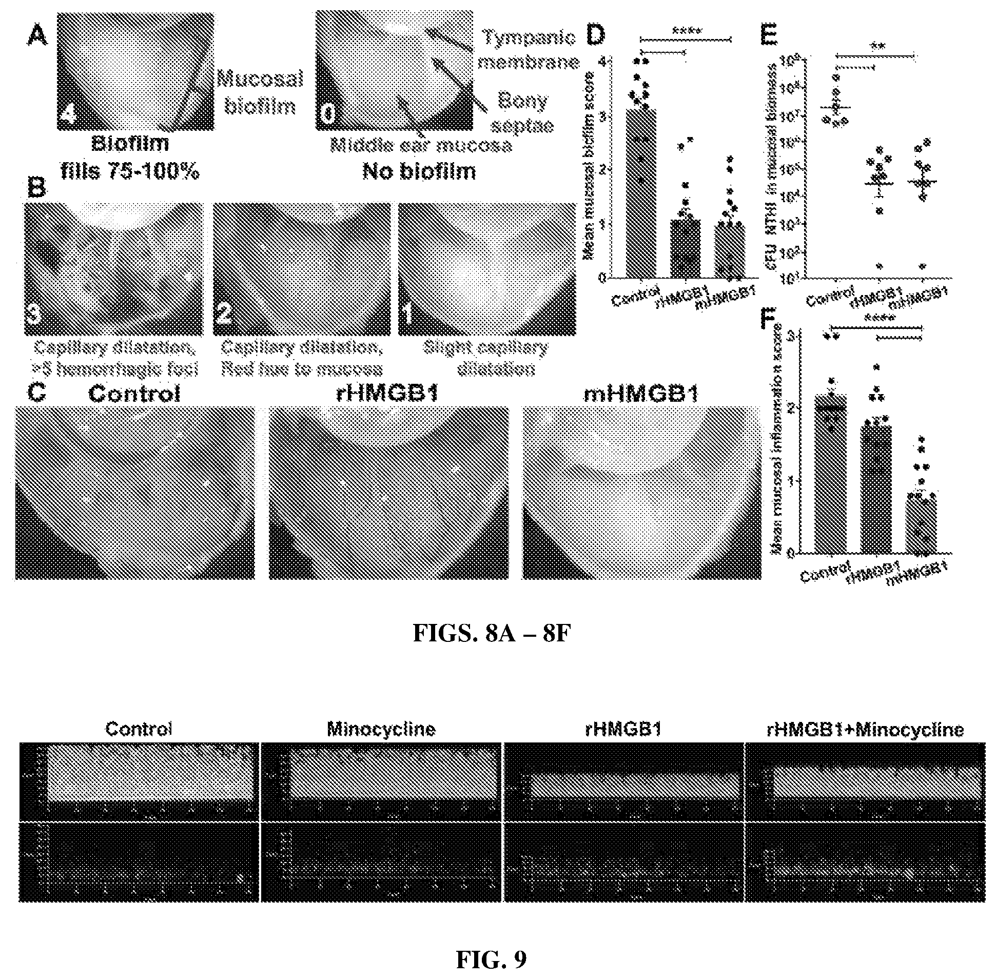 Patent US12365710 Figure 6 – HMGB1 protein derivatives for the removal of biofilms
