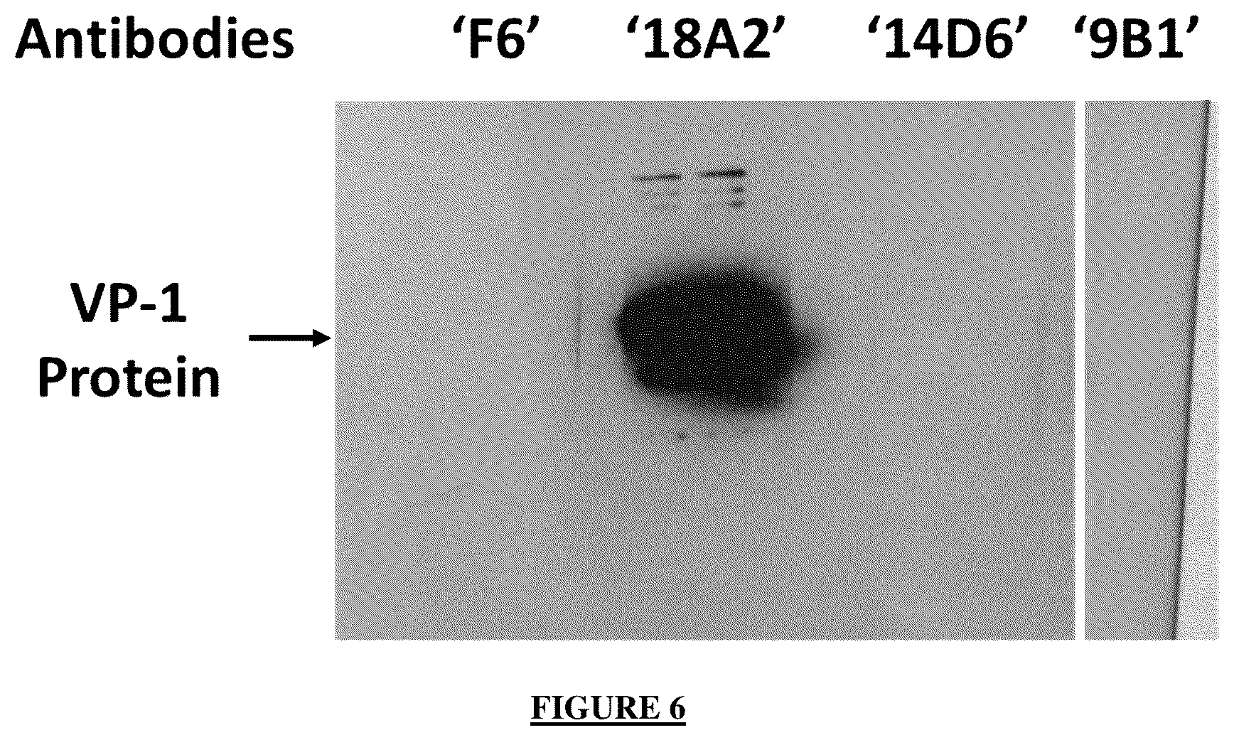 Patent US12365721 Figure 5 – Antibody targeting the VP-1 protein, fragments thereof, and uses of same for detecting infection with the BK polyomavirus