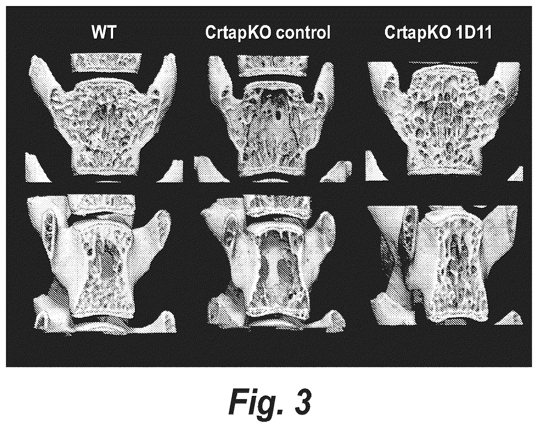 Patent US12365725 Figure 3 – Methods for treating osteogenesis imperfecta