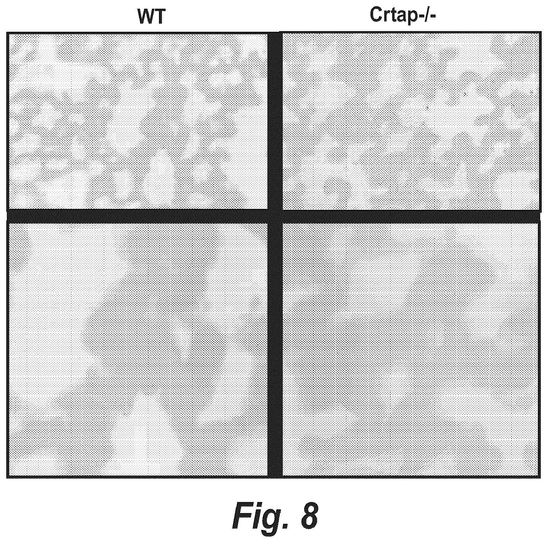 Patent US12365725 Figure 9 – Methods for treating osteogenesis imperfecta