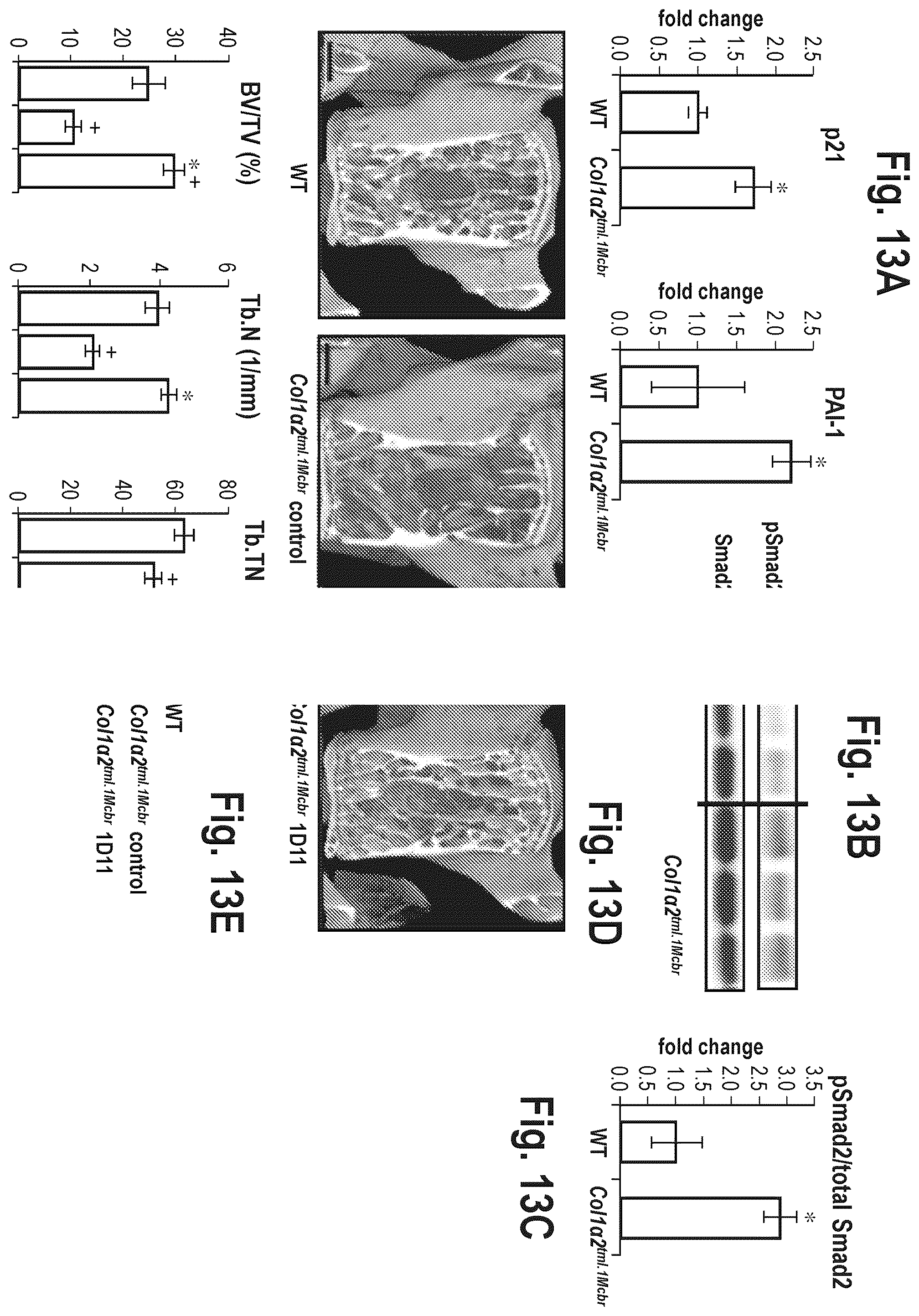 Patent US12365725 Figure 14 – Methods for treating osteogenesis imperfecta