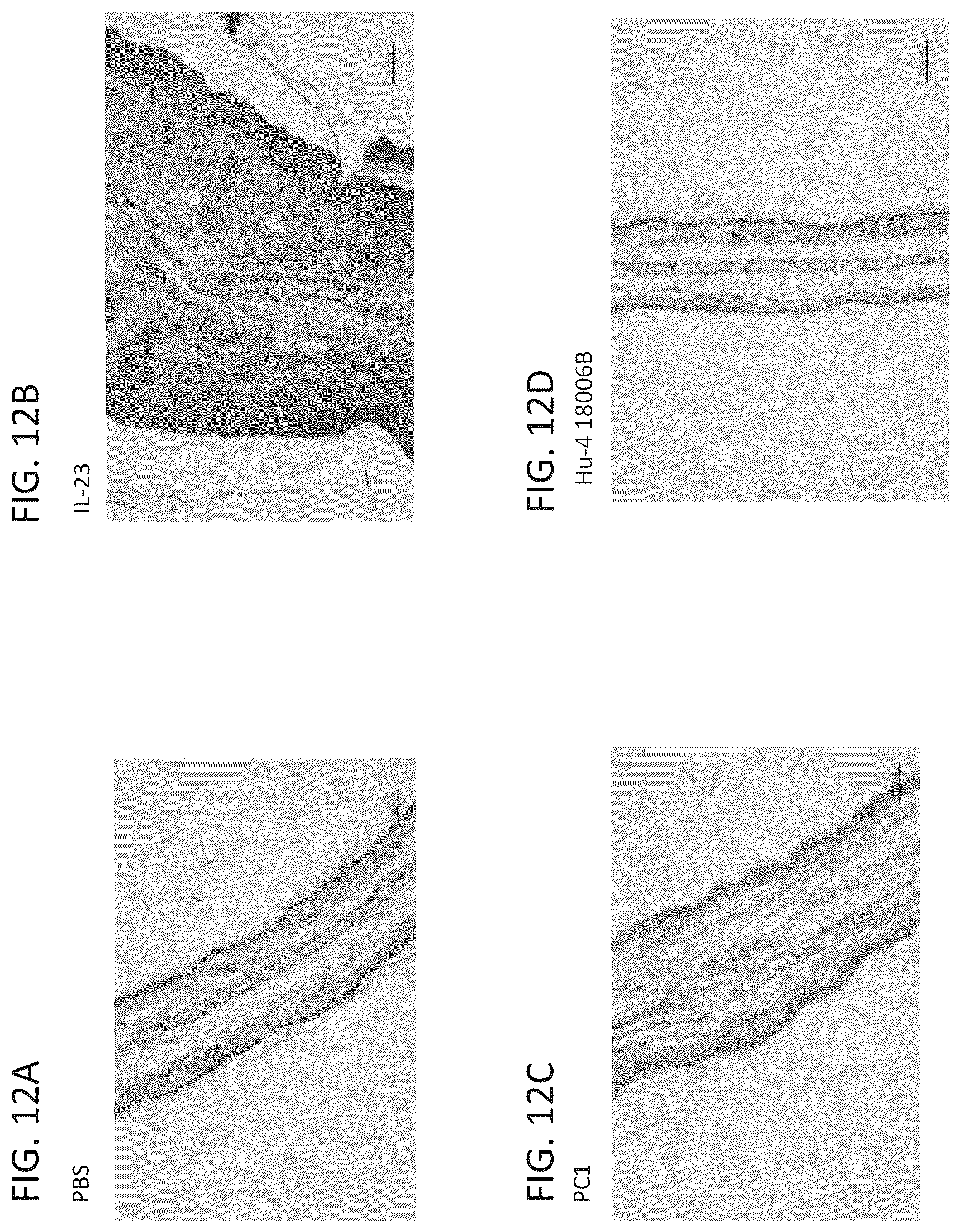 Patent US12365727 Figure 18 – Anti-interleukin-23 P19 antibodies and methods of use thereof