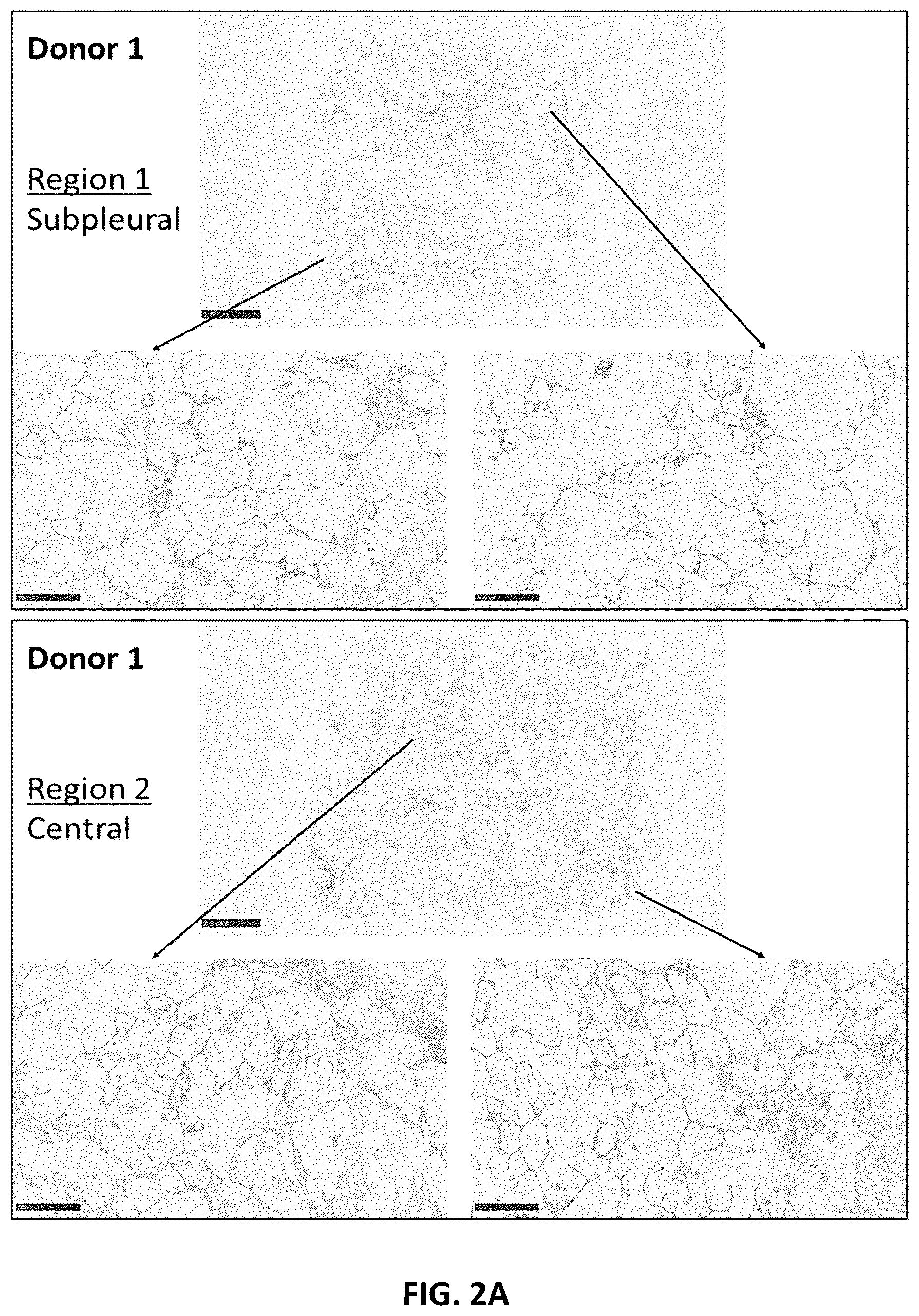 Patent US12365738 Figure 3 – Method of treating an interleukin-11-associated or -mediated fibrotic disease or condition by administering an anti-interleukin-11 receptor subunit alpha (IL-11RA) antibody