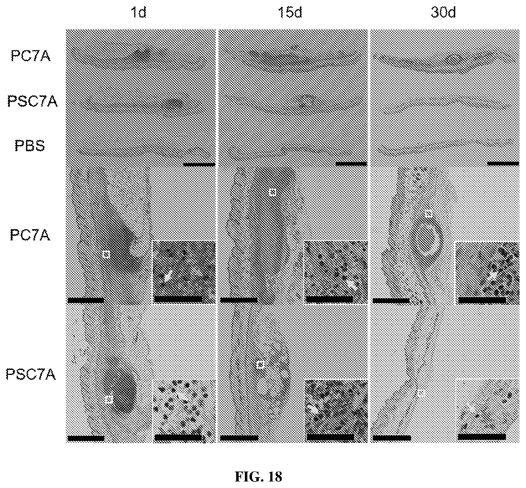 Patent US12365761 Figure 15 – Biodegradable ultra-pH sensitive polymers