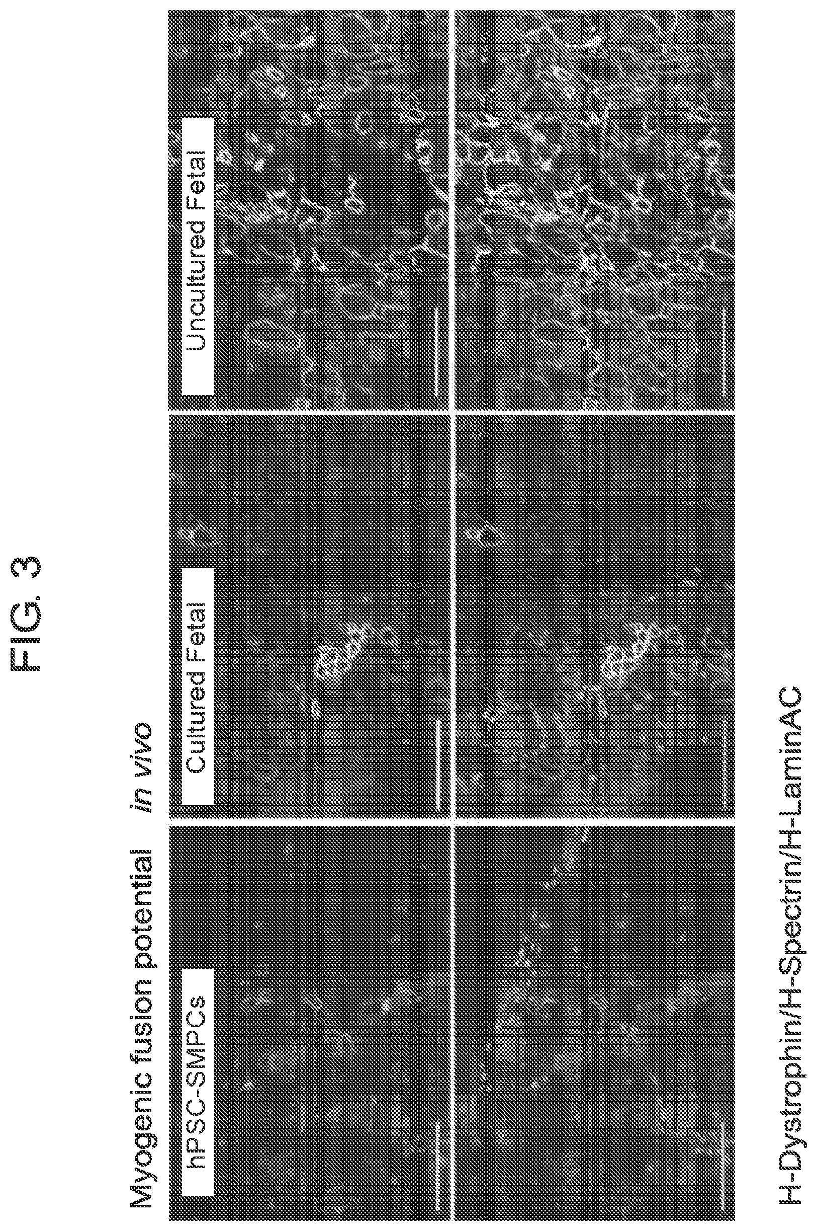 Patent US12365875 Figure 8 – Methods for generating skeletal muscle progenitor cells