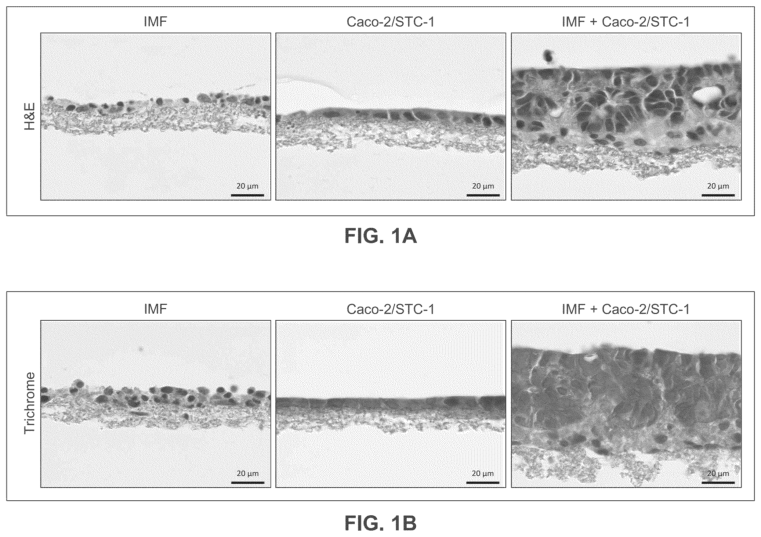 Patent US12365877 Figure 1 – Engineered intestinal tissue and uses thereof