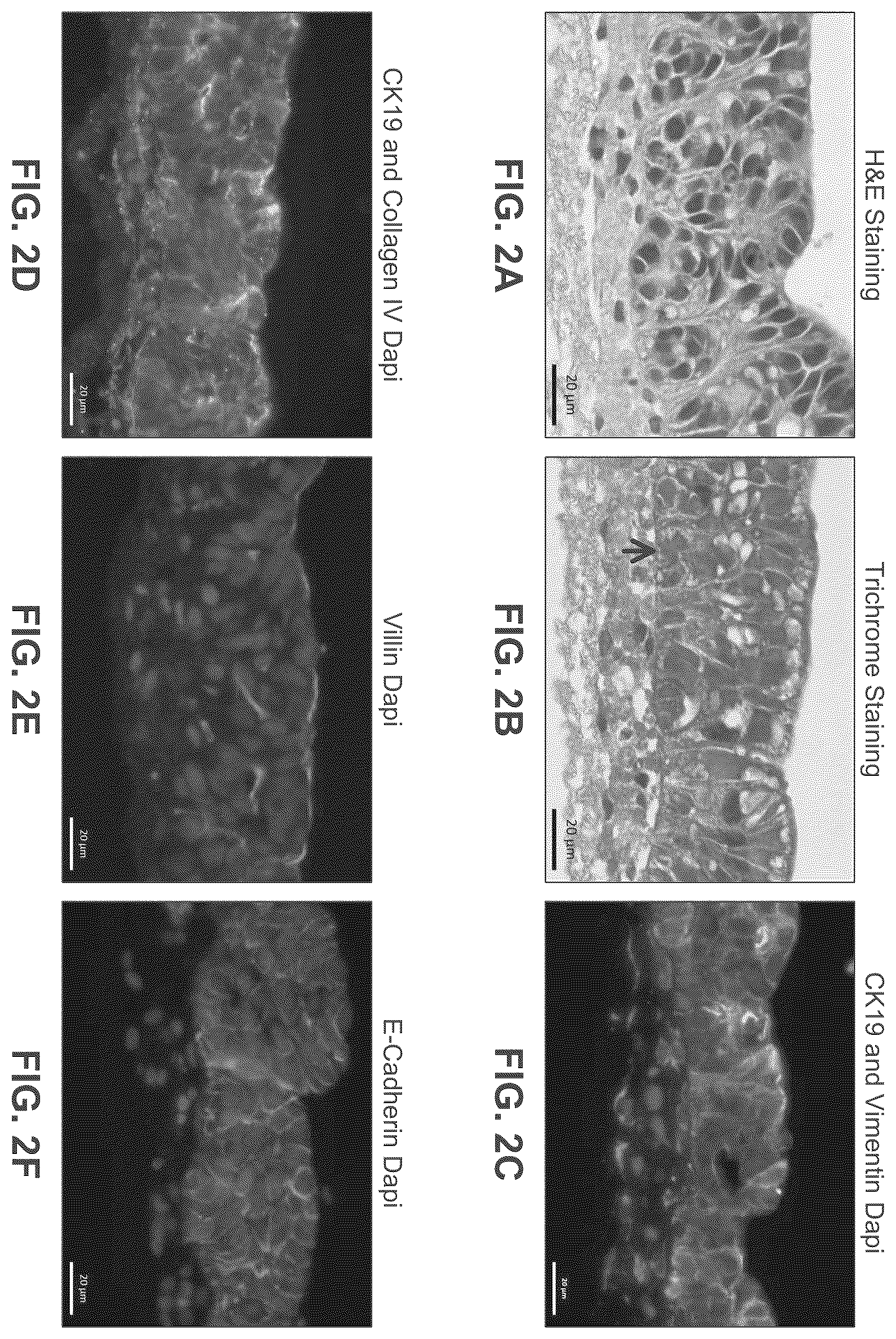 Patent US12365877 Figure 2 – Engineered intestinal tissue and uses thereof