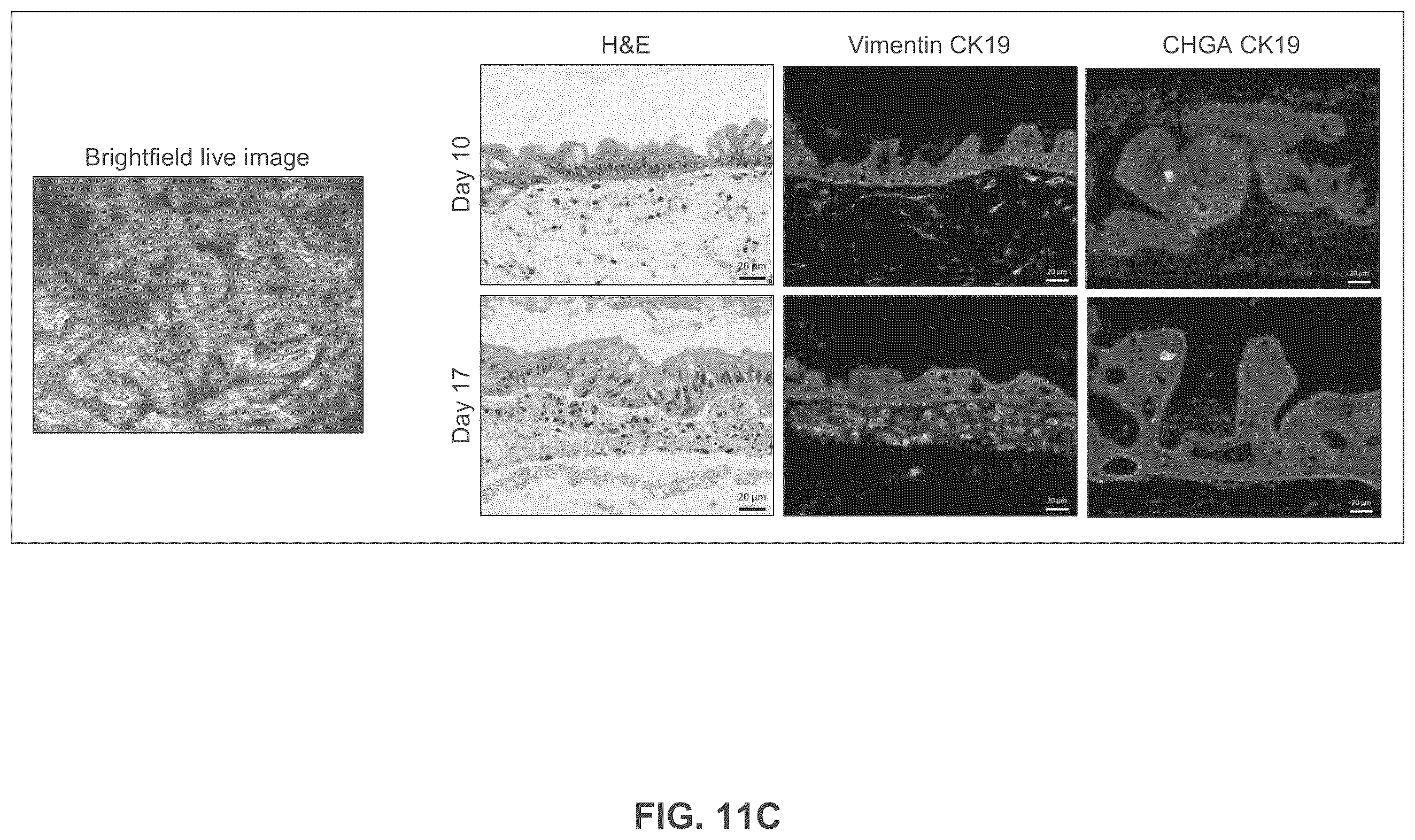 Patent US12365877 Figure 13 – Engineered intestinal tissue and uses thereof