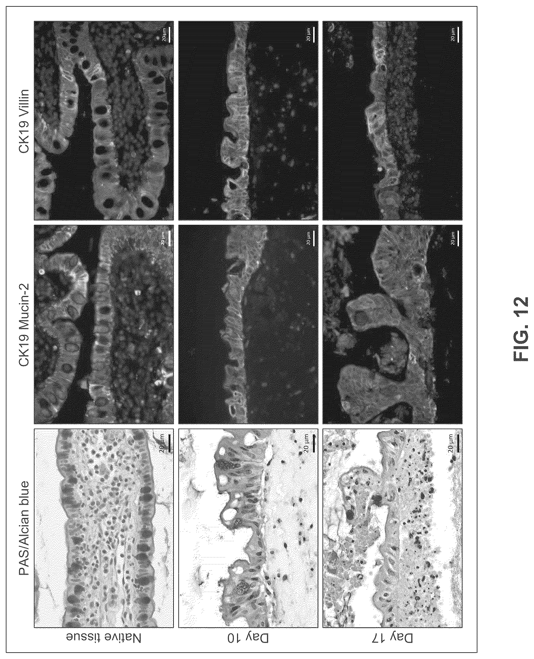 Patent US12365877 Figure 15 – Engineered intestinal tissue and uses thereof