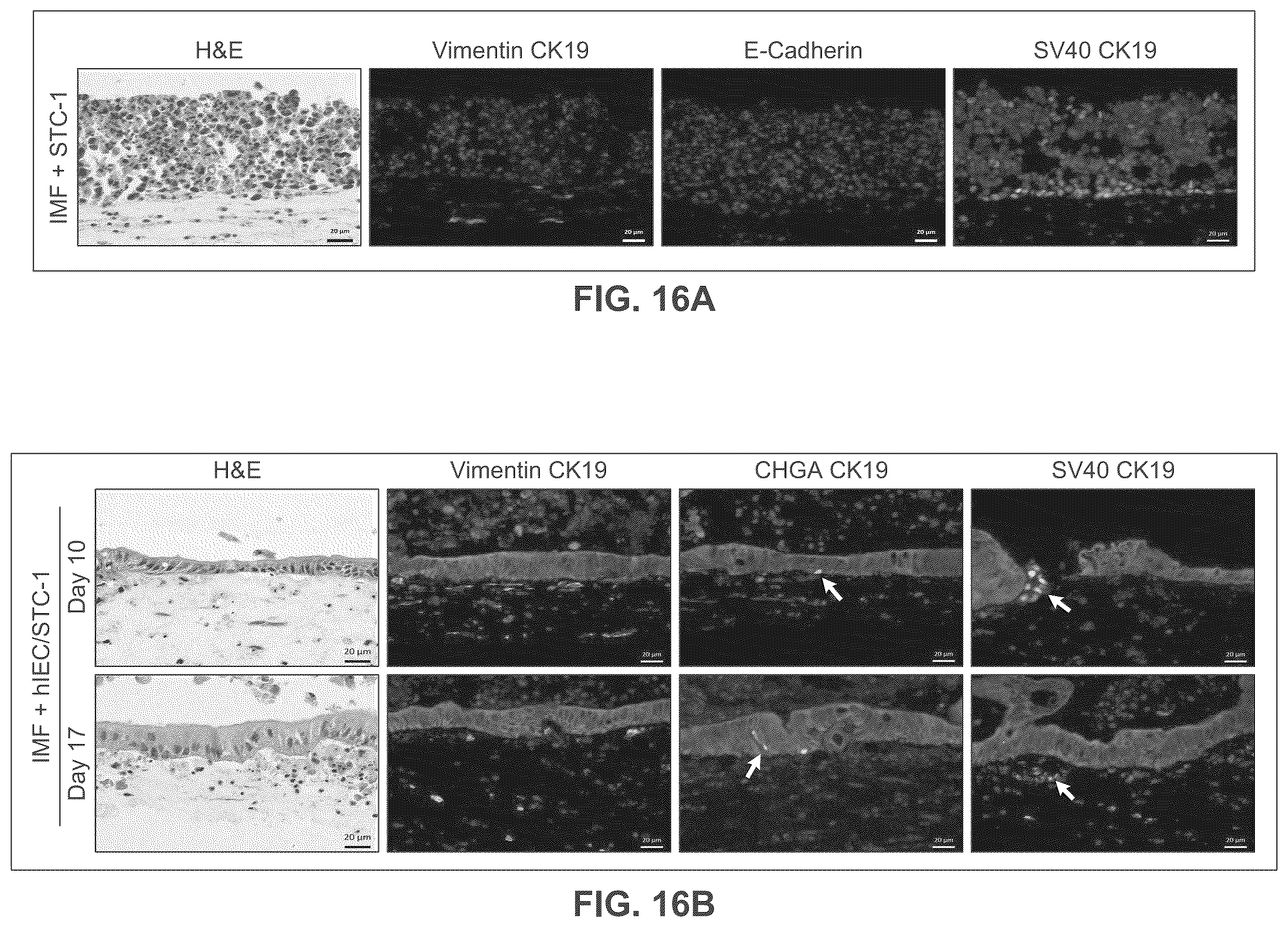 Patent US12365877 Figure 20 – Engineered intestinal tissue and uses thereof